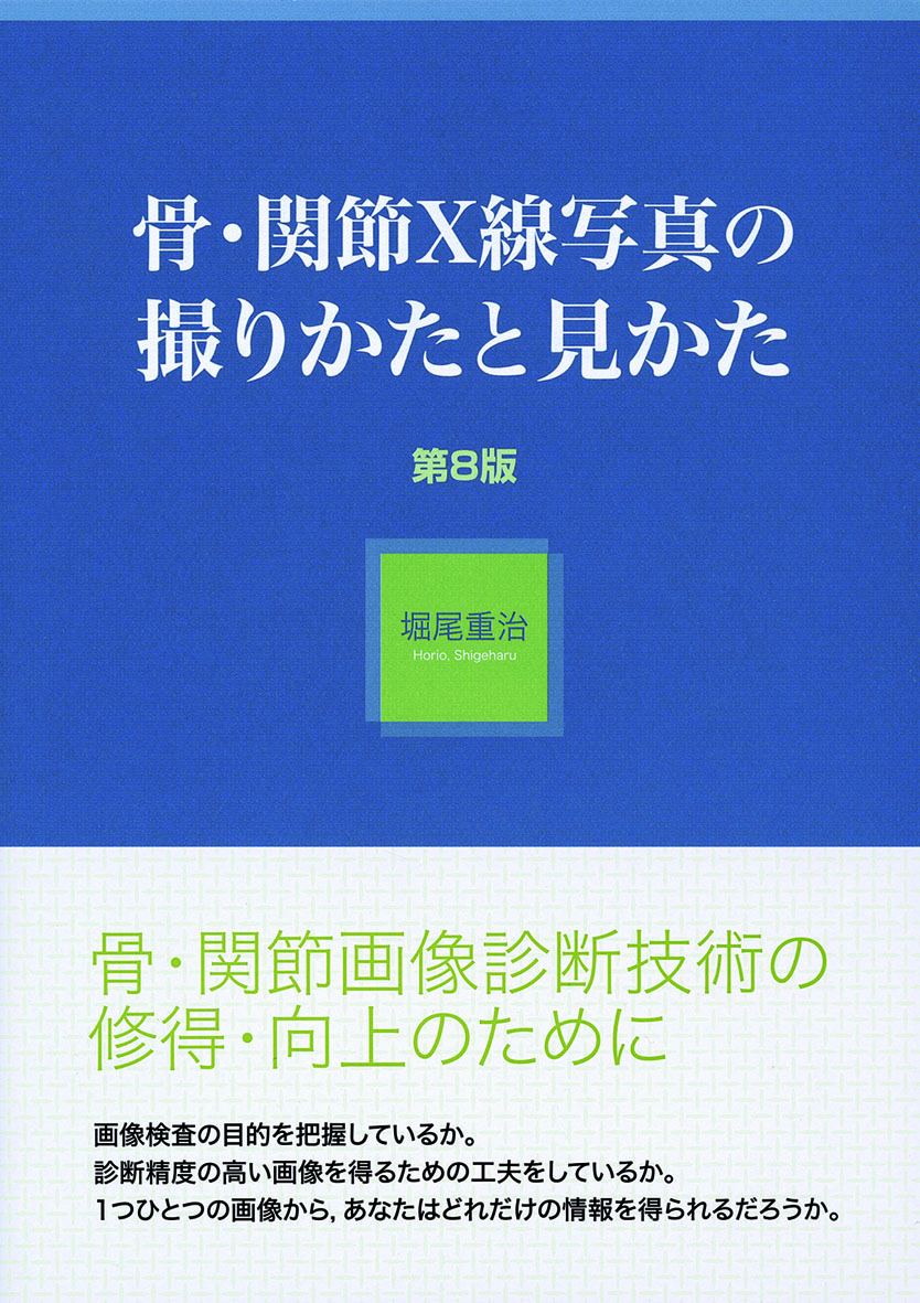 骨・関節X線写真の撮りかたと見かた 第8版【電子版】 | 医書.jp