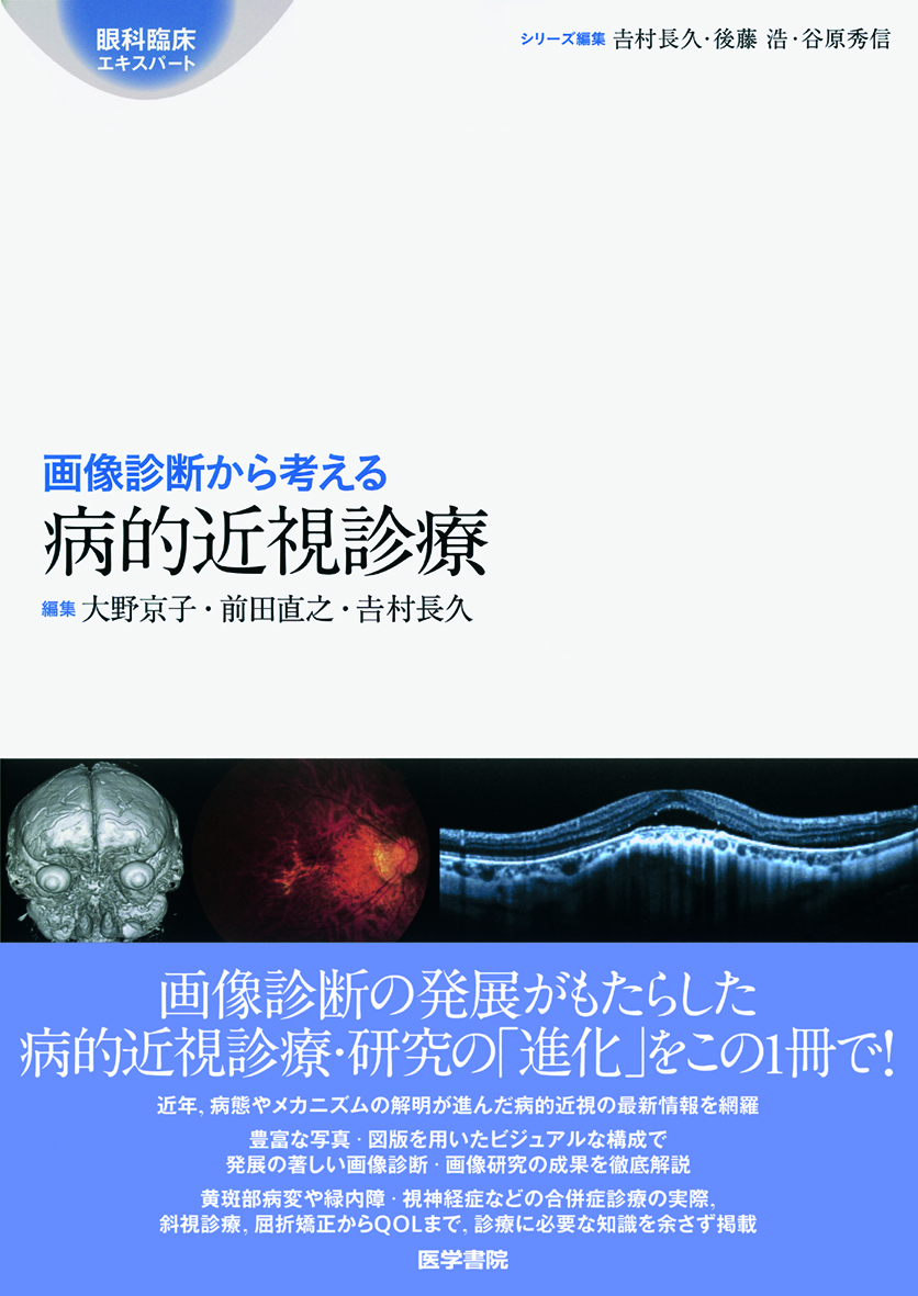 画像診断から考える病的近視診療【電子版】 | 医書.jp