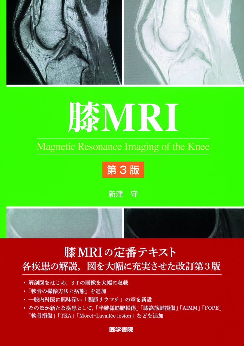 膝MRI 第3版【電子版】 | 医書.jp