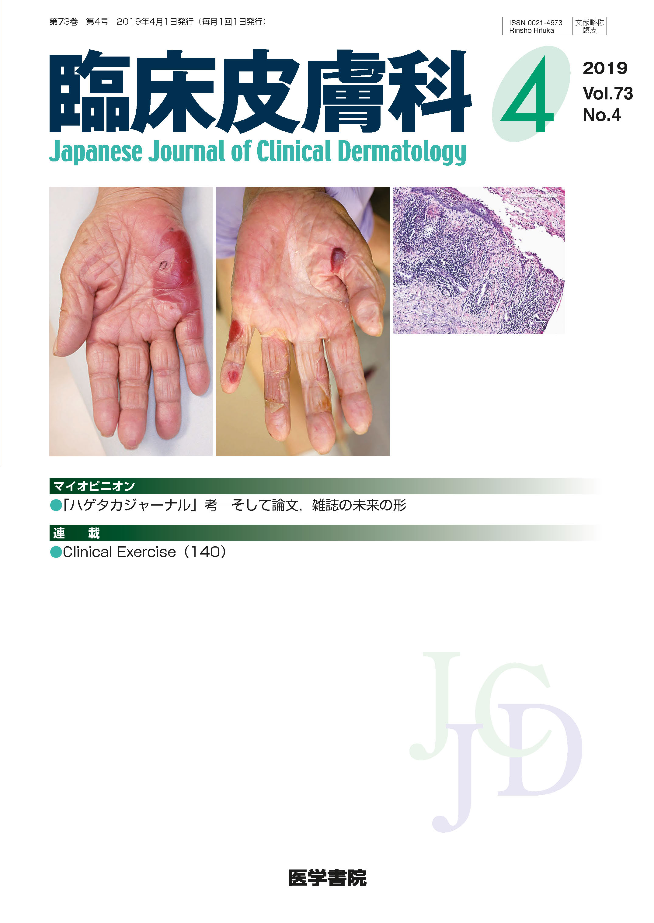 臨床皮膚科 Vol 73 No 4 電子版 医書 Jp