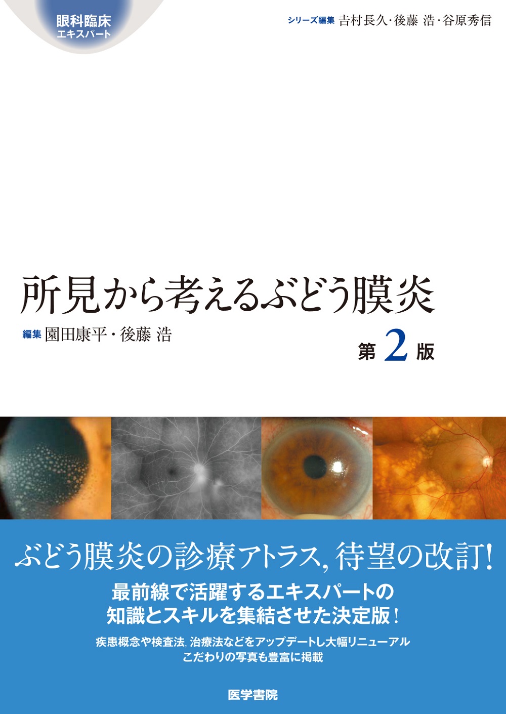 【裁断済み】所見から考えるぶどう膜炎　第2版