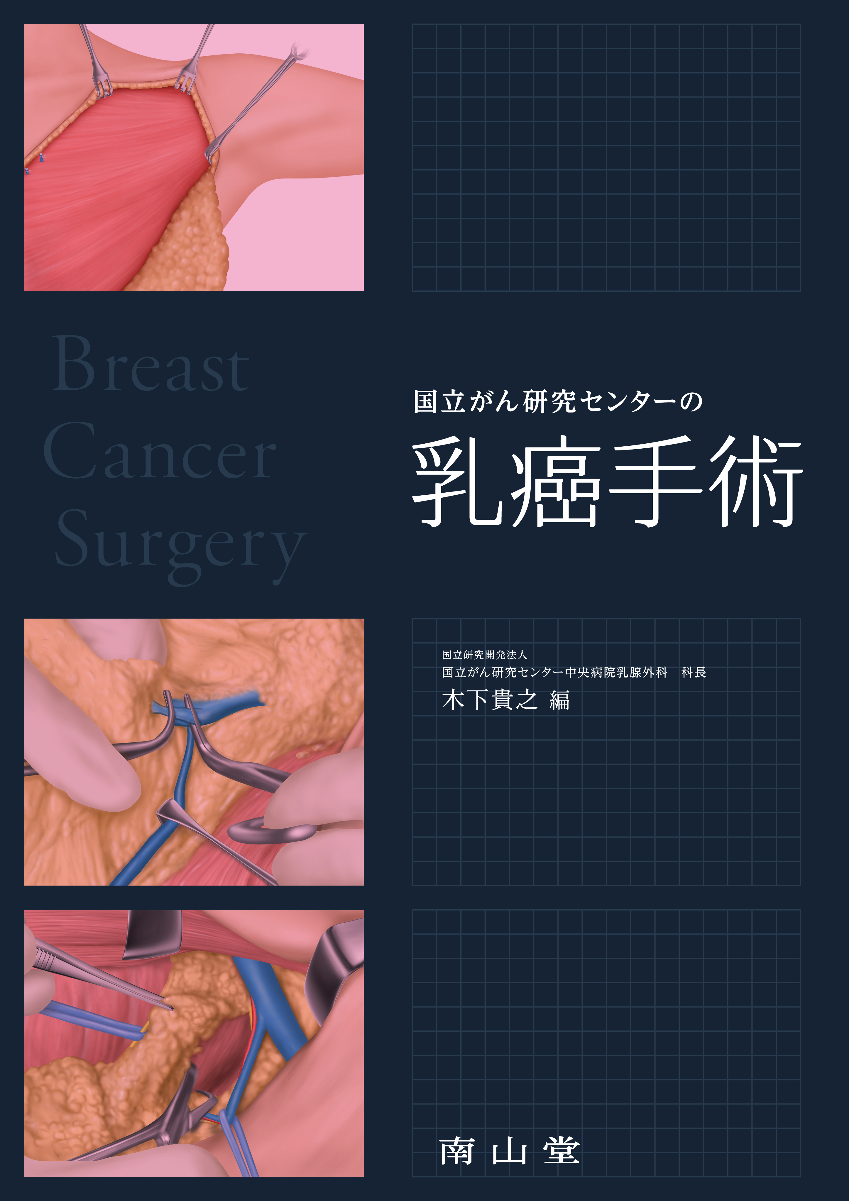 乳がん 手術