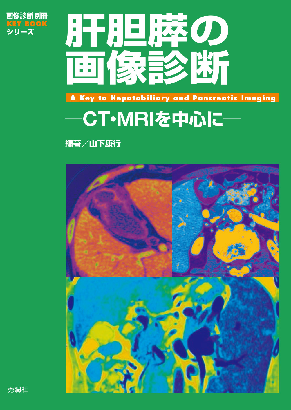 肝胆膵の画像診断 ─CT・MRIを中心に─【電子版】 | 医書.jp