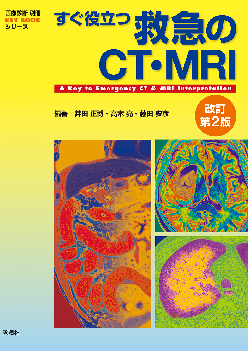 すぐ役立つ救急のＣＴ・ＭＲＩ 改訂第２版【電子版】 | 医書.jp