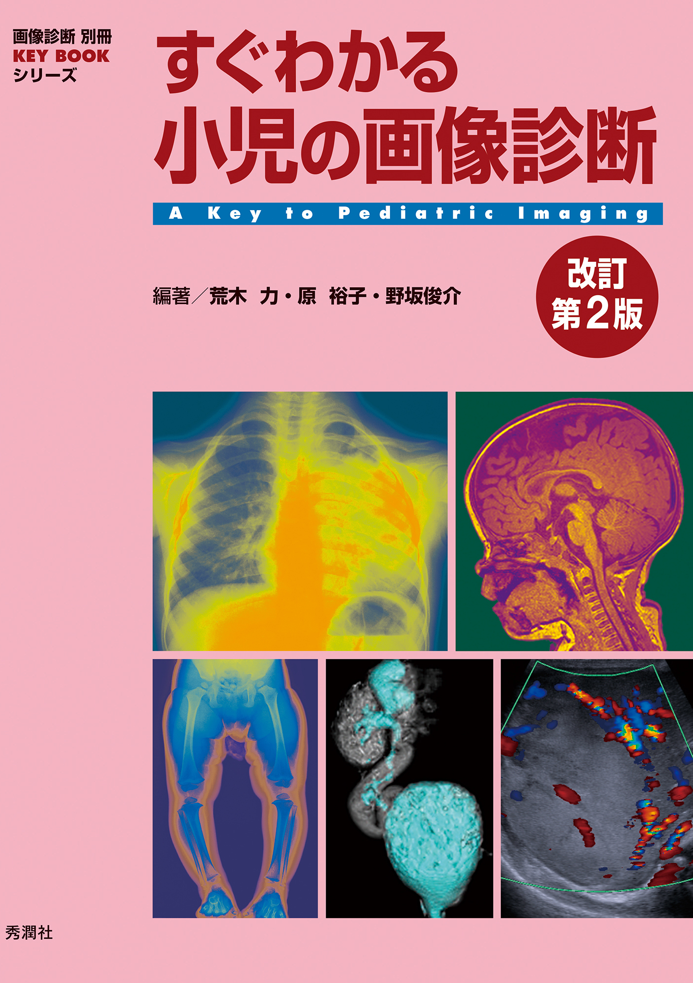 すぐわかる小児の画像診断改訂第2版【電子版】 | 医書.jp