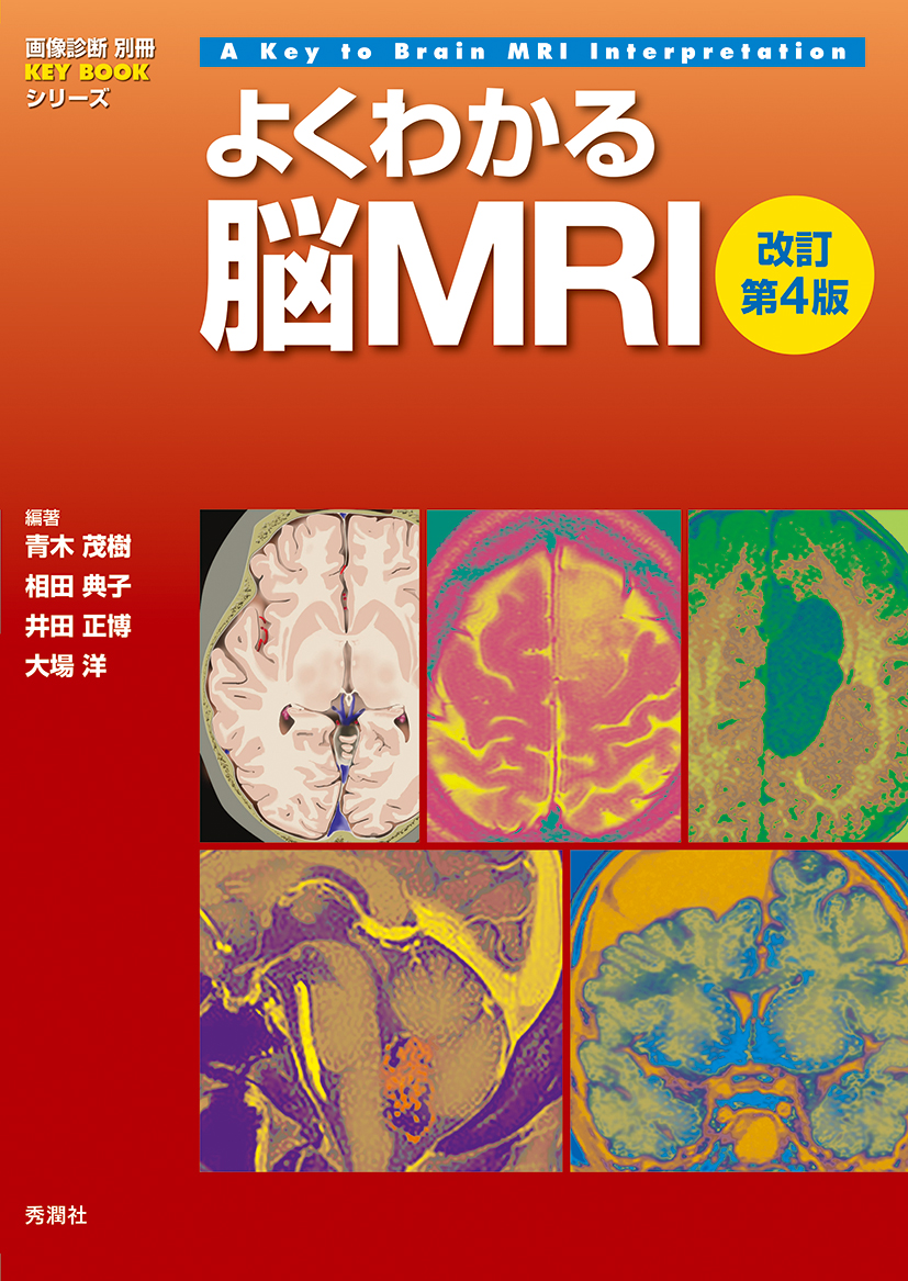 よくわかる脳ＭＲＩ 改訂第4版【電子版】 | 医書.jp