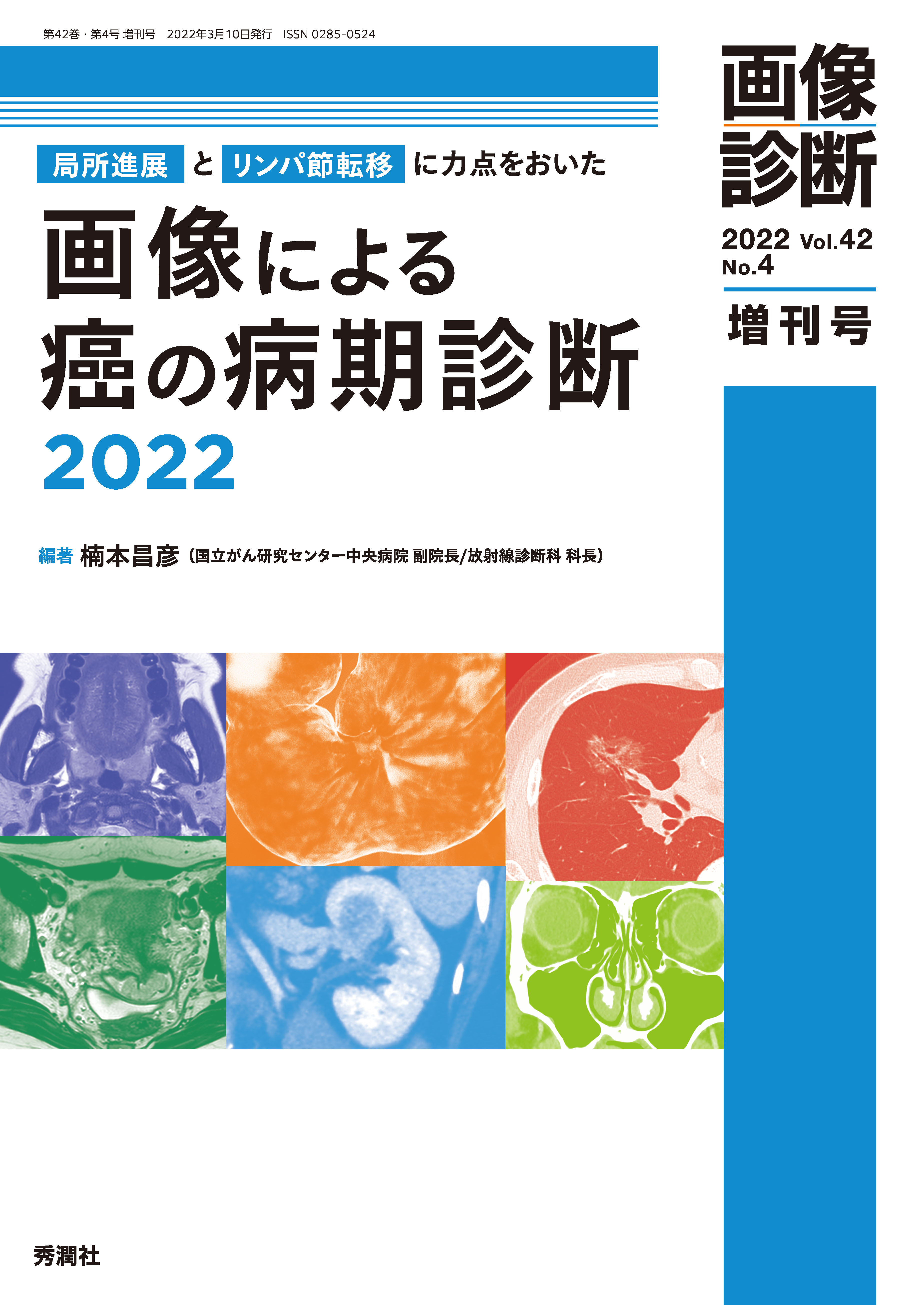画像診断 Vol.42 No.4（2022年増刊号）【電子版】 | 医書.jp