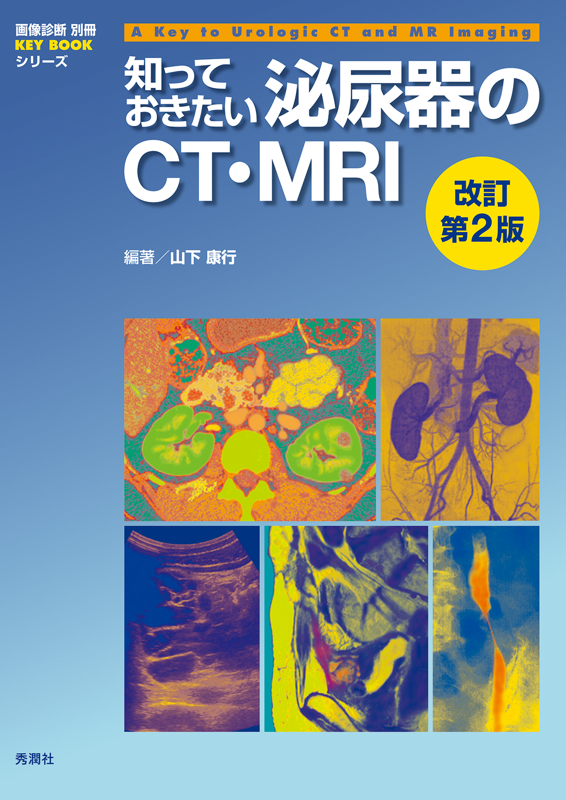 知っておきたい泌尿器のＣＴ・ＭＲＩ改訂第２版【電子版】 | 医書.jp