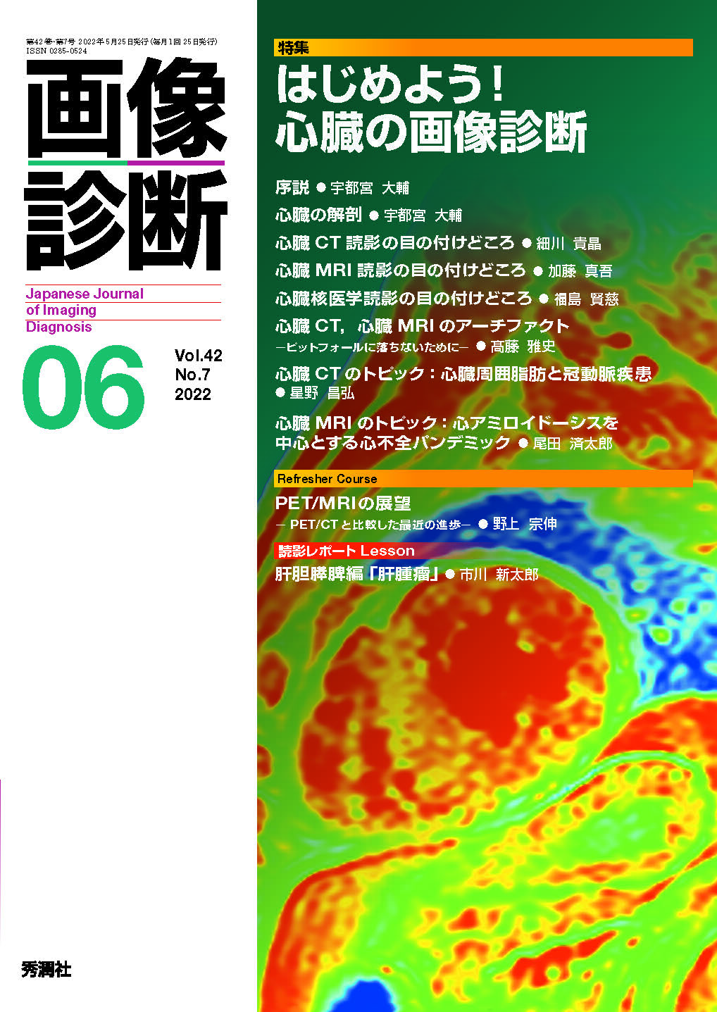 画像診断 Vol.42 No.7（2022年6月号）【電子版】 | 医書.jp