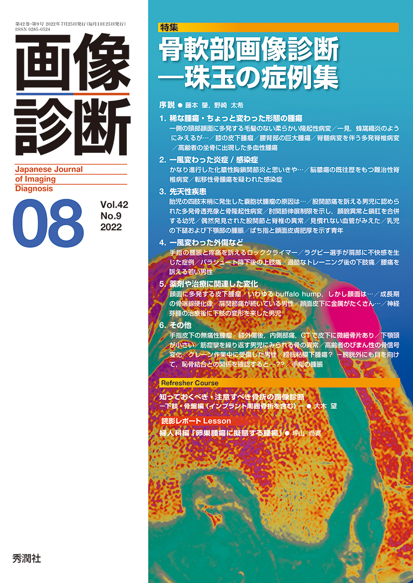 画像診断 Vol.42 No.9（2022年8月号）【電子版】 | 医書.jp