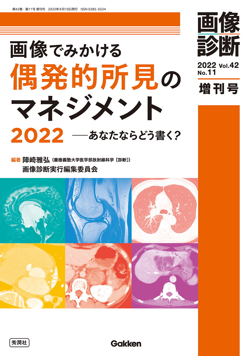 画像診断 Vol.42 No.11（2022年増刊号）【電子版】 | 医書.jp