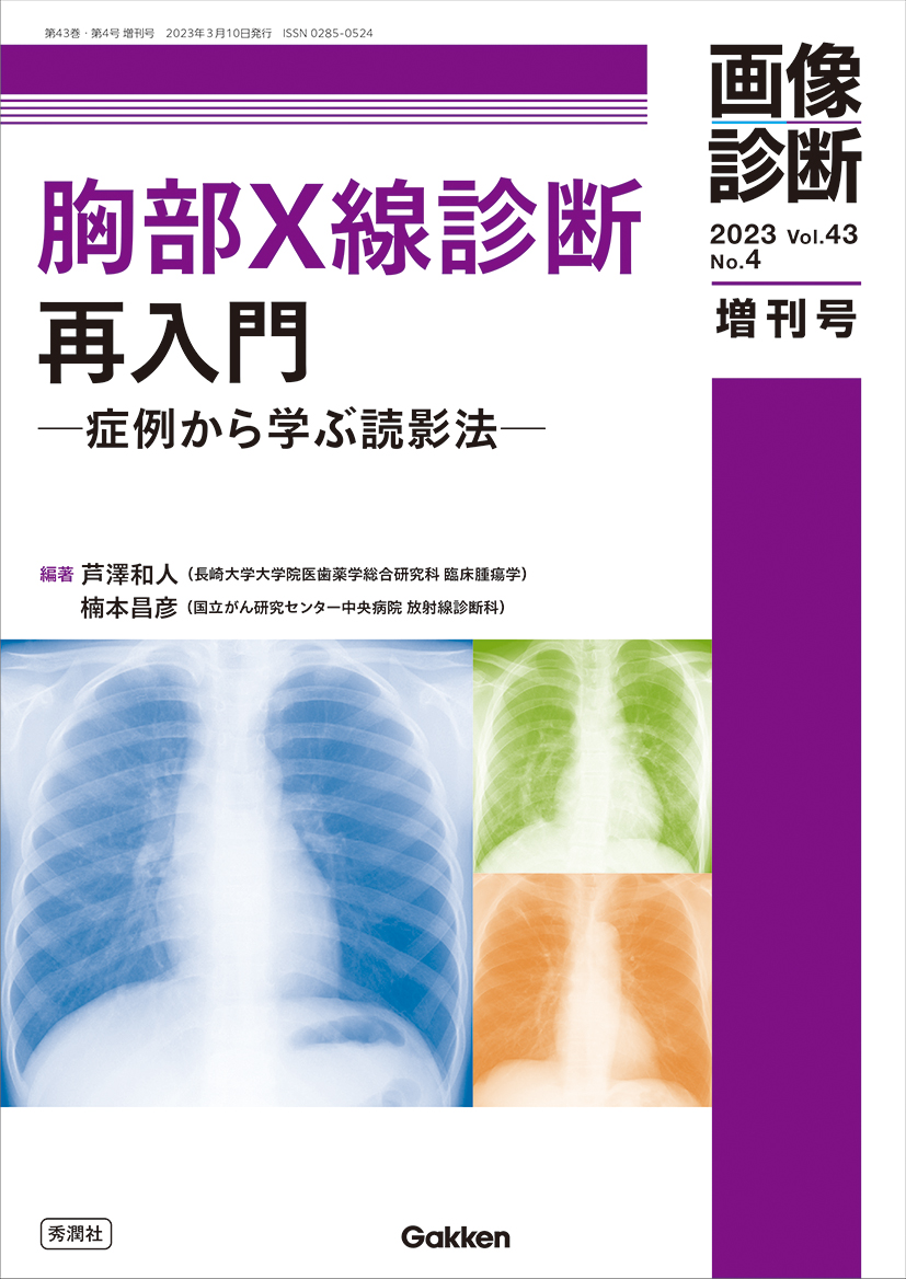画像診断 Vol.43 No.4（2023年増刊号）【電子版】 | 医書.jp
