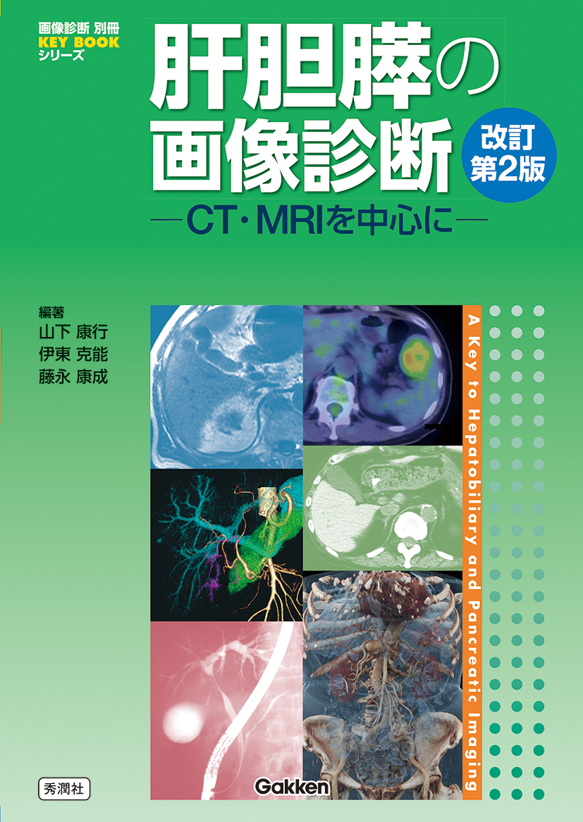 肝胆膵の画像診断 ─CT・MRIを中心に─ 改訂第２版【電子版】 | 医書.jp