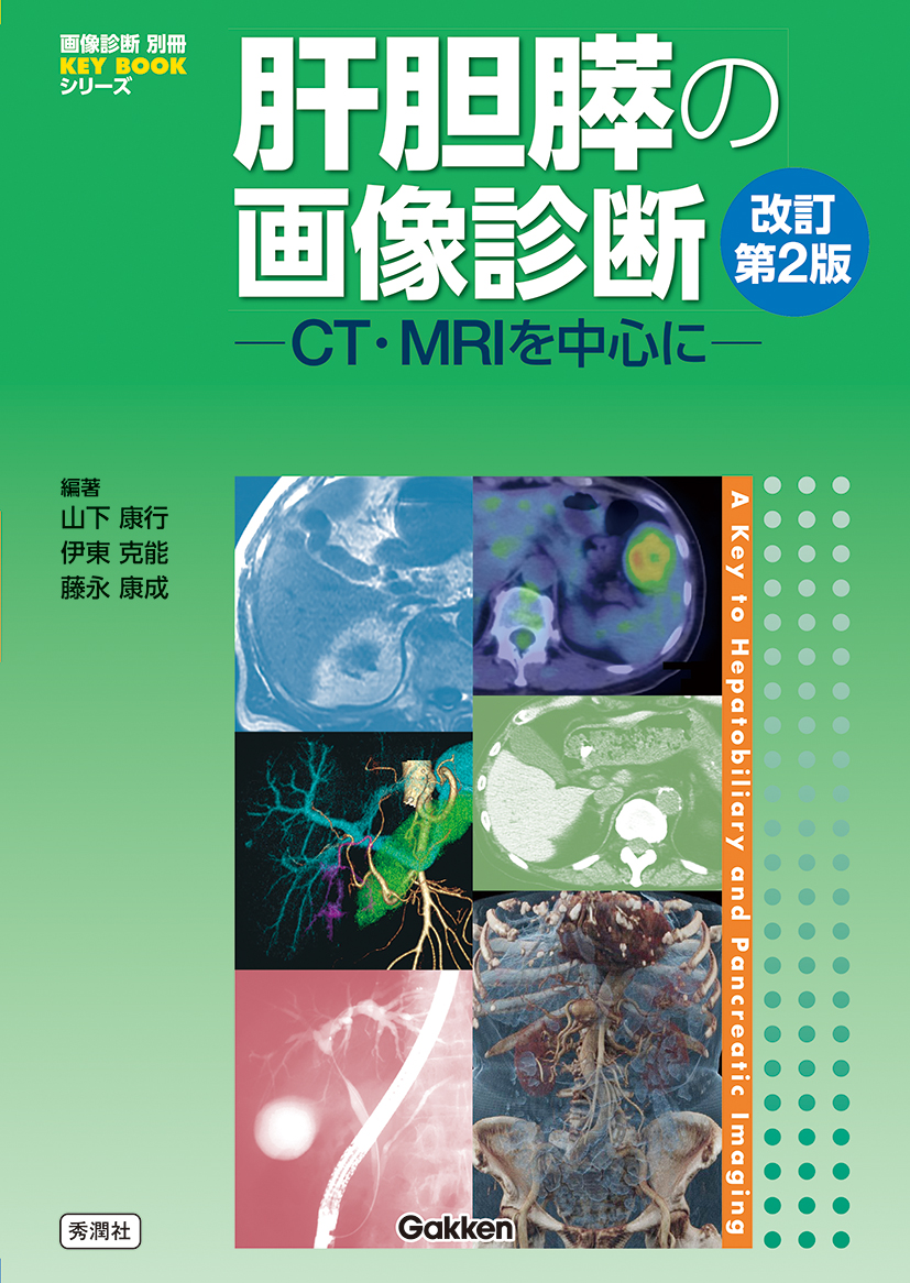 裁断済) 肝胆膵の画像診断―CT・MRIを中心に 改訂第2版 - 健康/医学