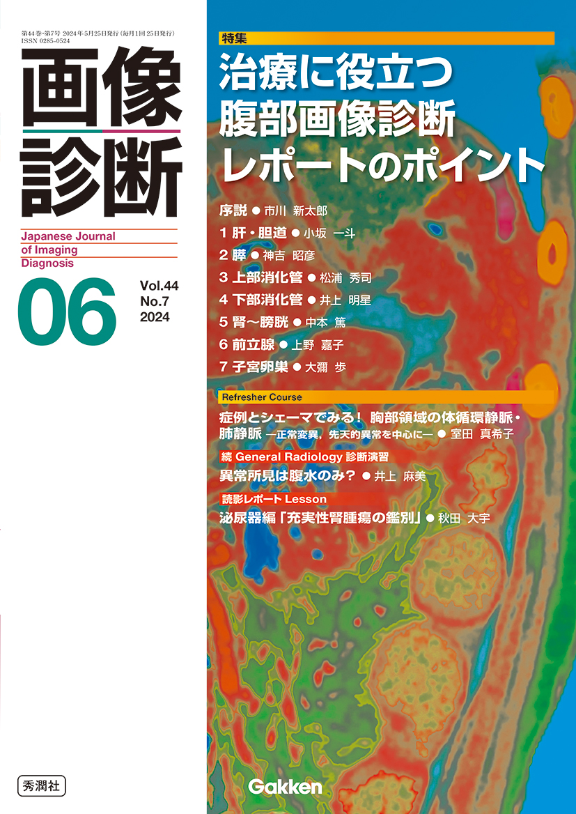 画像診断 Vol.44 No.7（2024年6月号）【電子版】 | 医書.jp