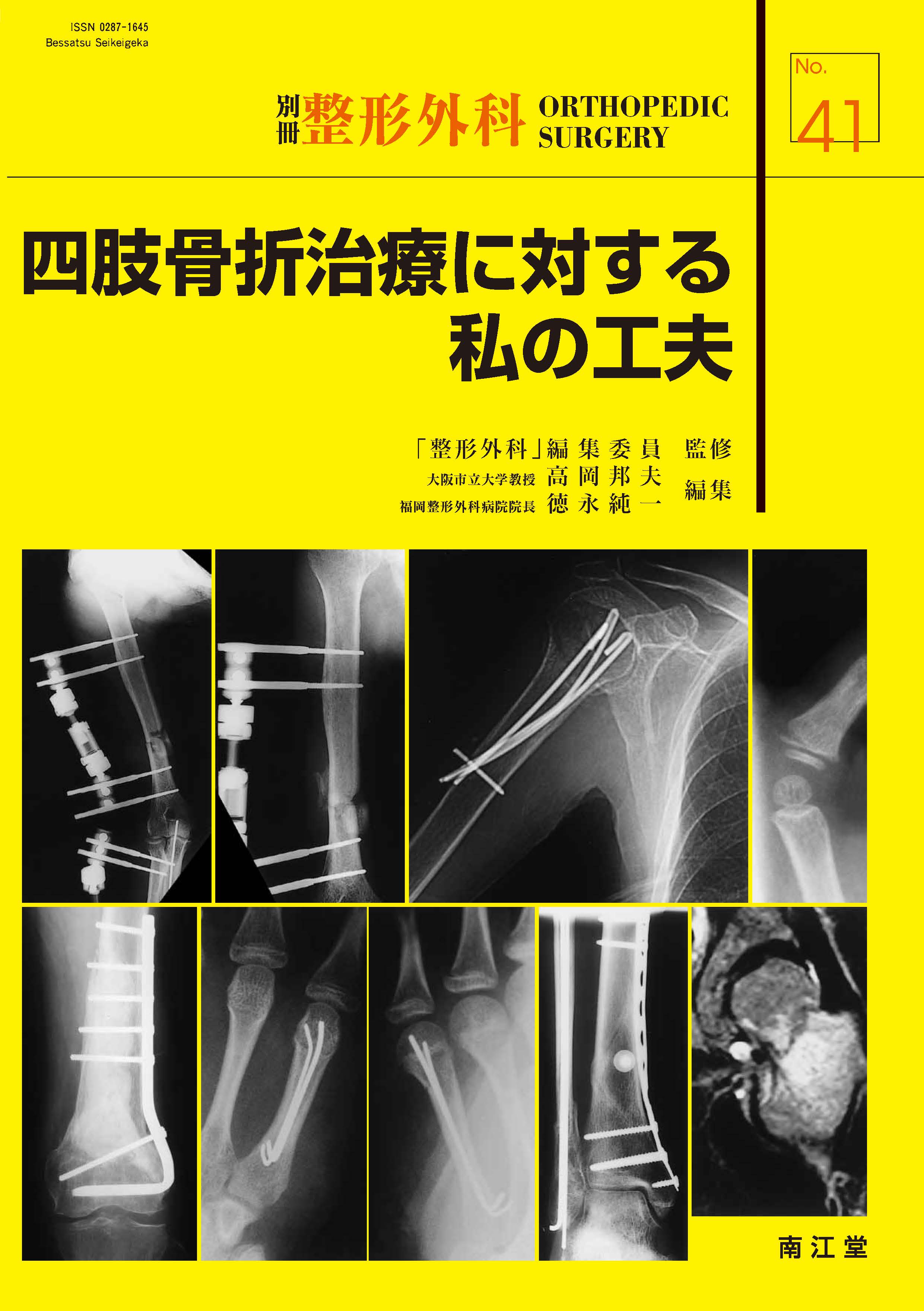 別冊整形外科 No.41 四肢骨折治療に対する私の工夫【電子版】 | 医書.jp