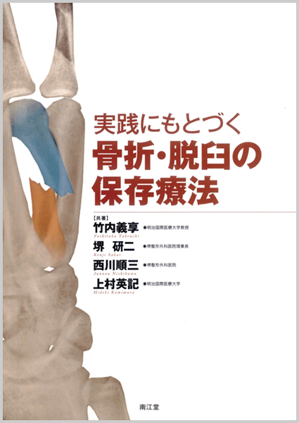 骨折・脱臼の保存療法【電子版】 | 医書.jp