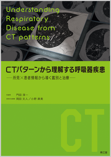 CTパターンから理解する呼吸器疾患【電子版】 | 医書.jp