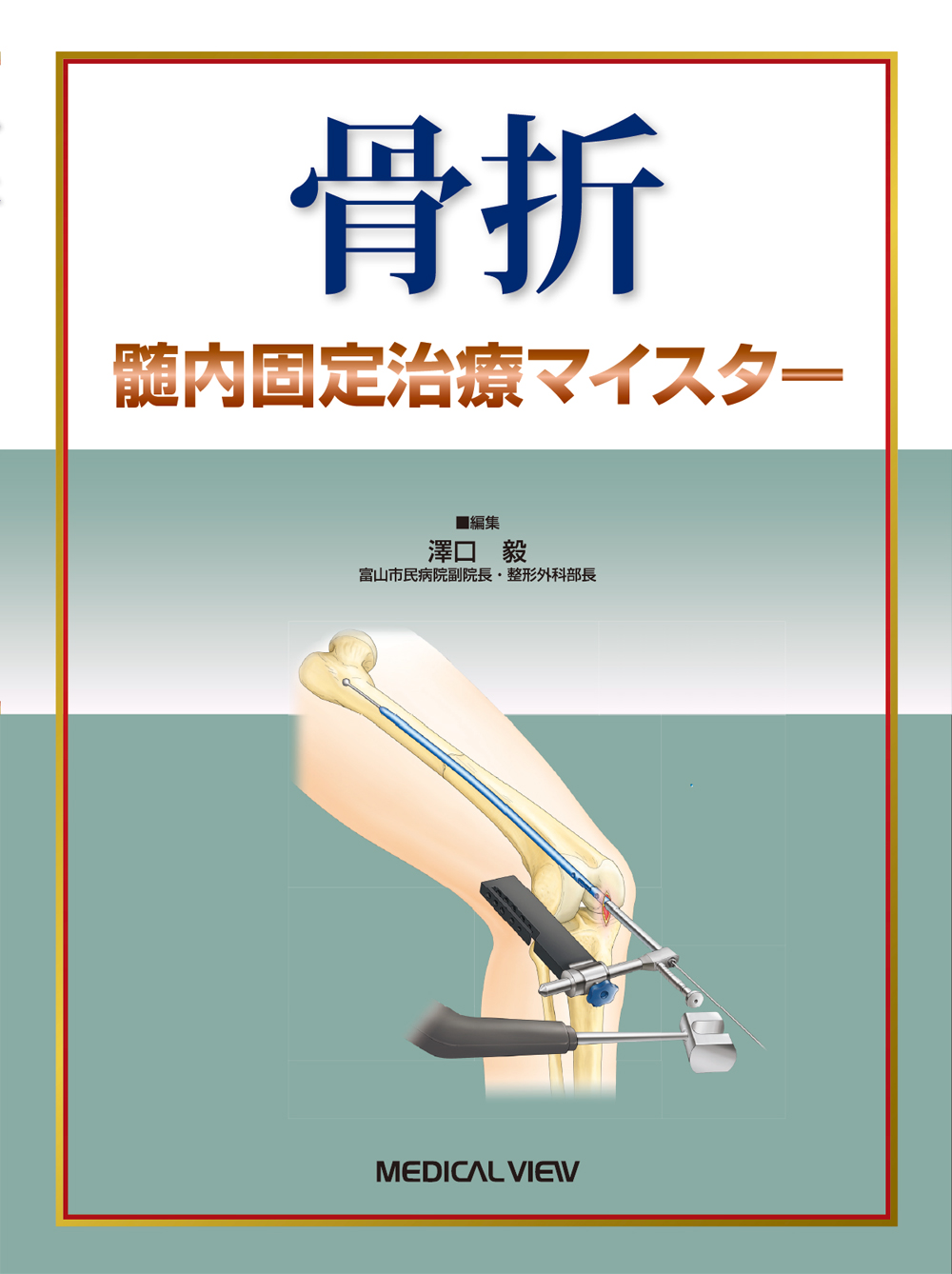 骨折 髄内固定治療マイスター【電子版】 | 医書.jp