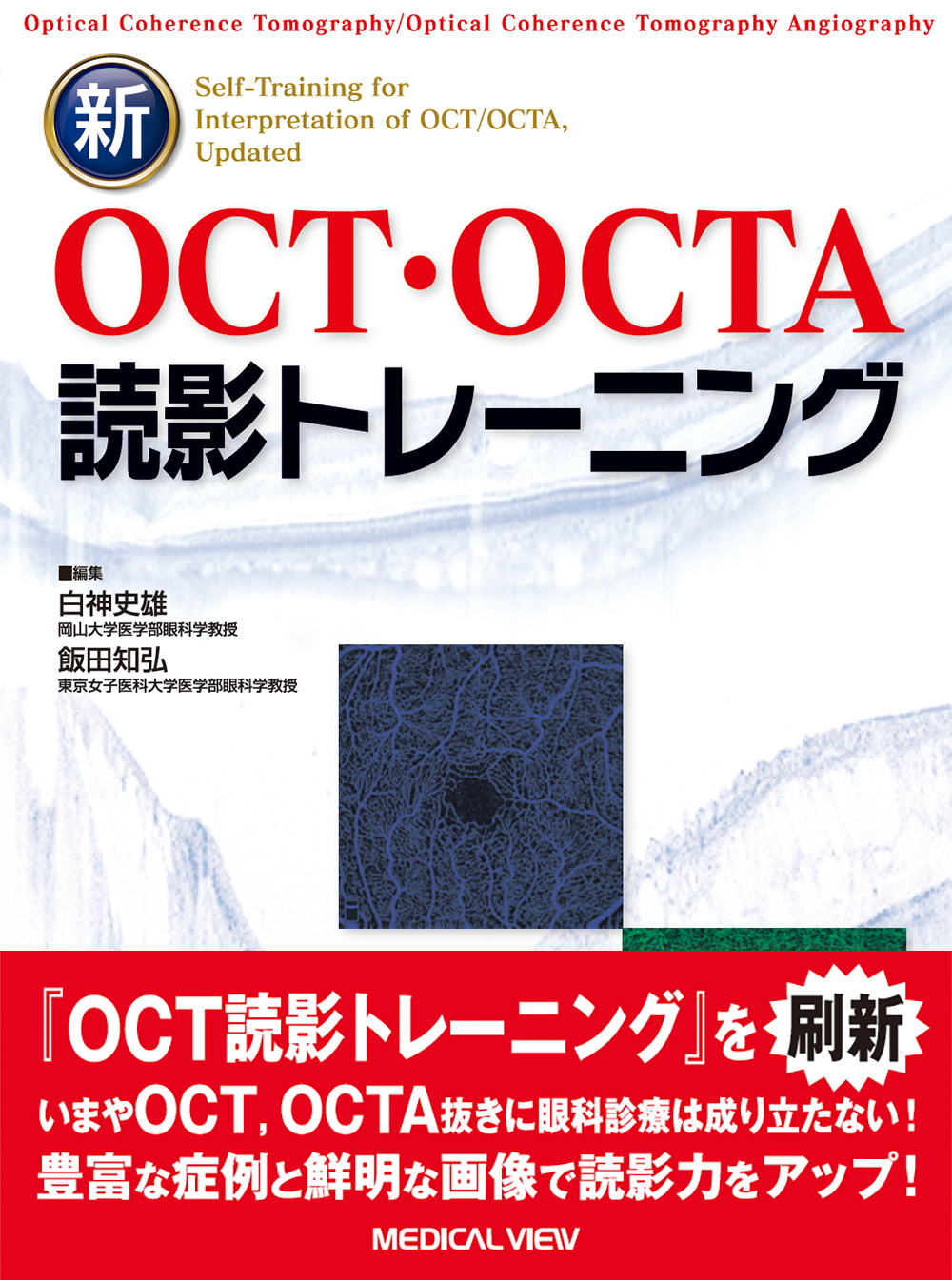 新OCT・OCTA読影トレーニング【電子版】 | 医書.jp