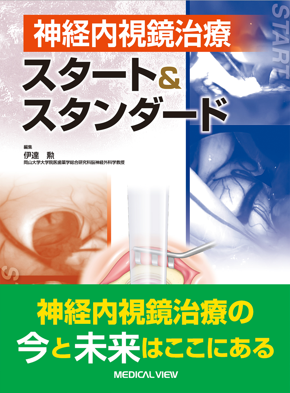 神経内視鏡治療 スタート＆スタンダード【電子版】 | 医書.jp