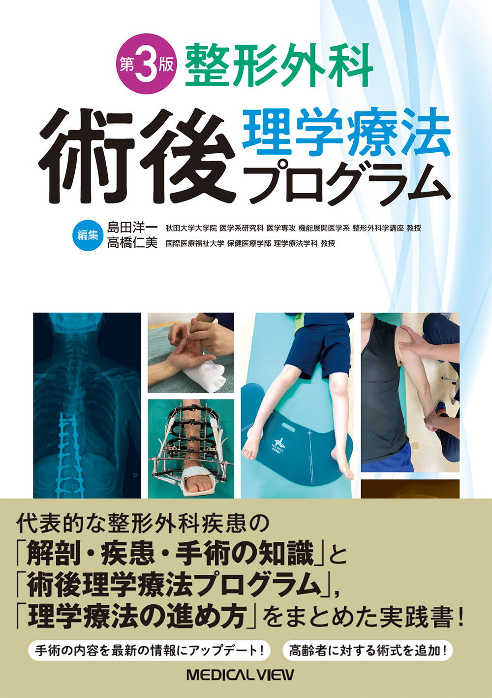 ここがポイント！整形外科疾患の理学療法 第３版