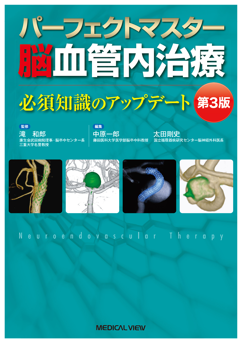 パーフェクトマスター脳血管内治療 第3版【電子版】 | 医書.jp