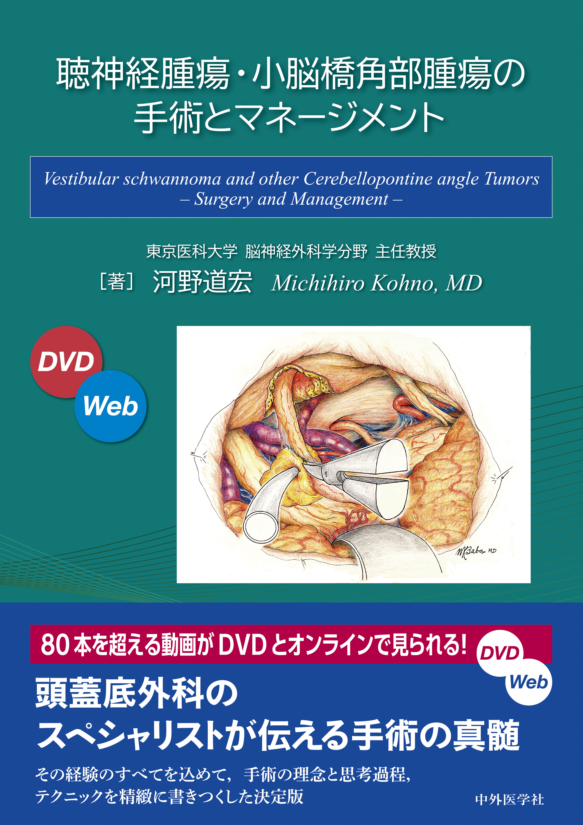 聴神経腫瘍・小脳橋角部腫瘍の手術とマネージメント【電子版】 | 医書.jp