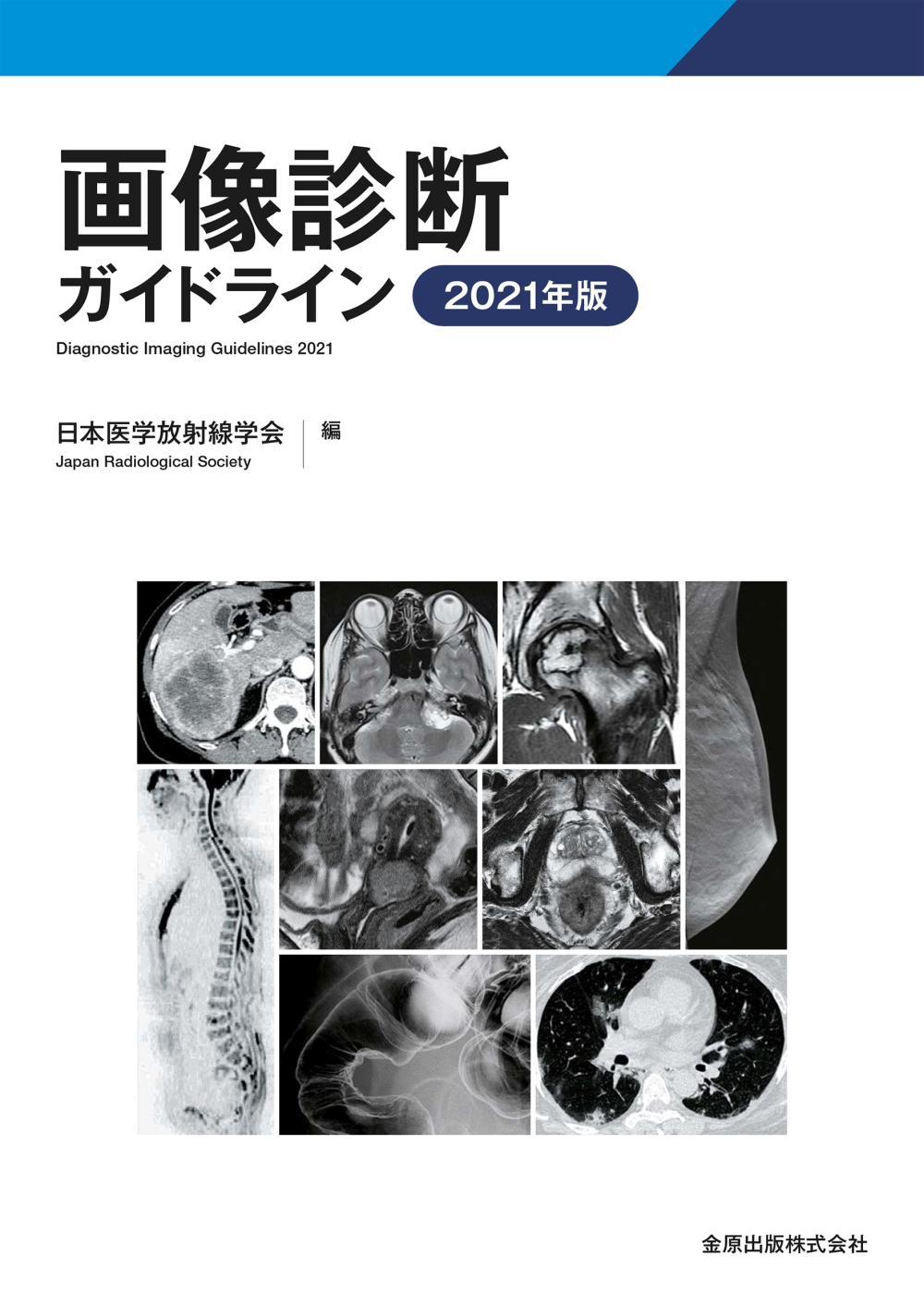 頭頸部のCT・MRI 胸部のCT 腹部のCT 肝胆膵のCT 急性腹症のCTセット-