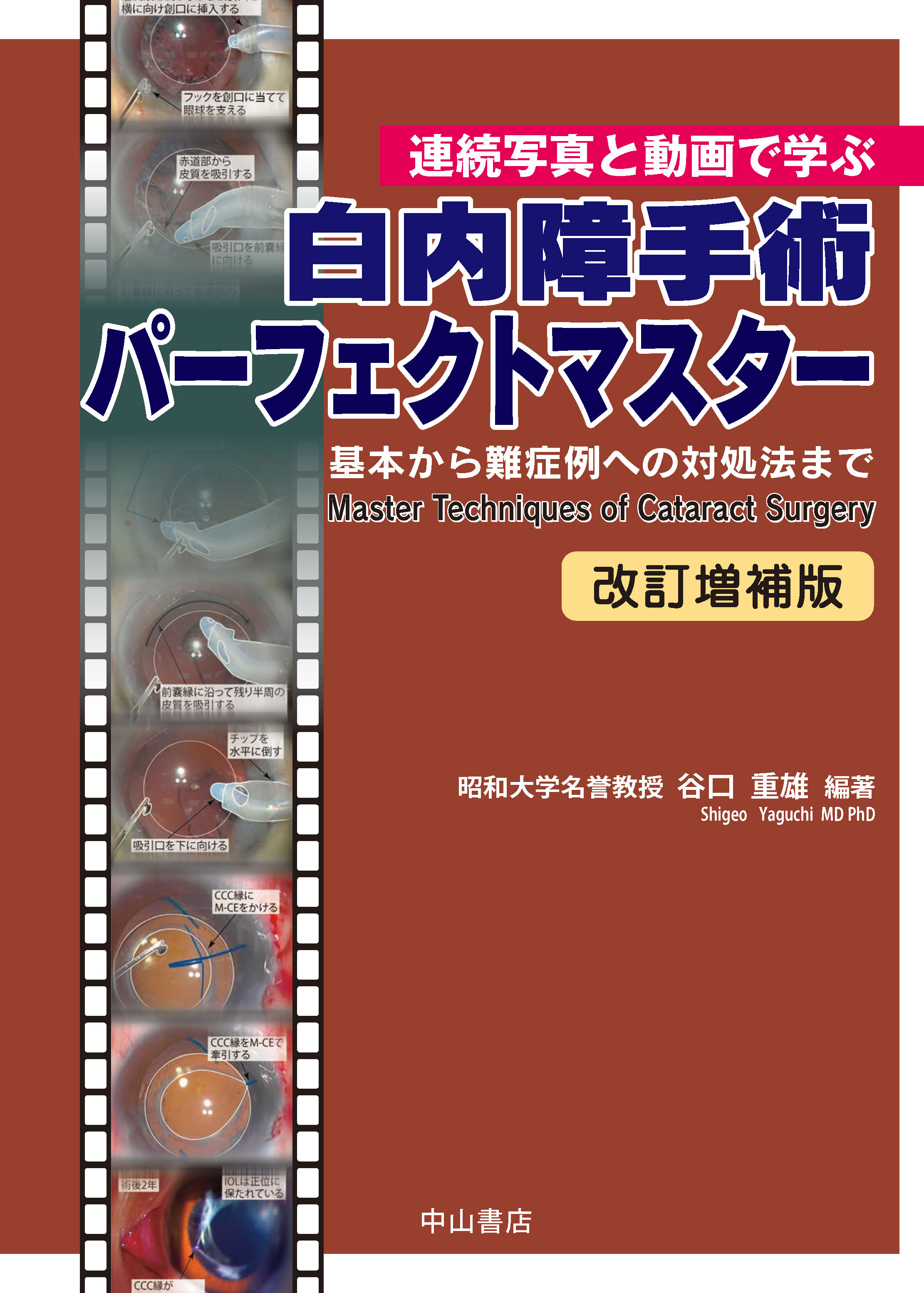 谷口重雄谷口重雄【裁断済み】白内障手術パーフェクトマスター　改訂増補版