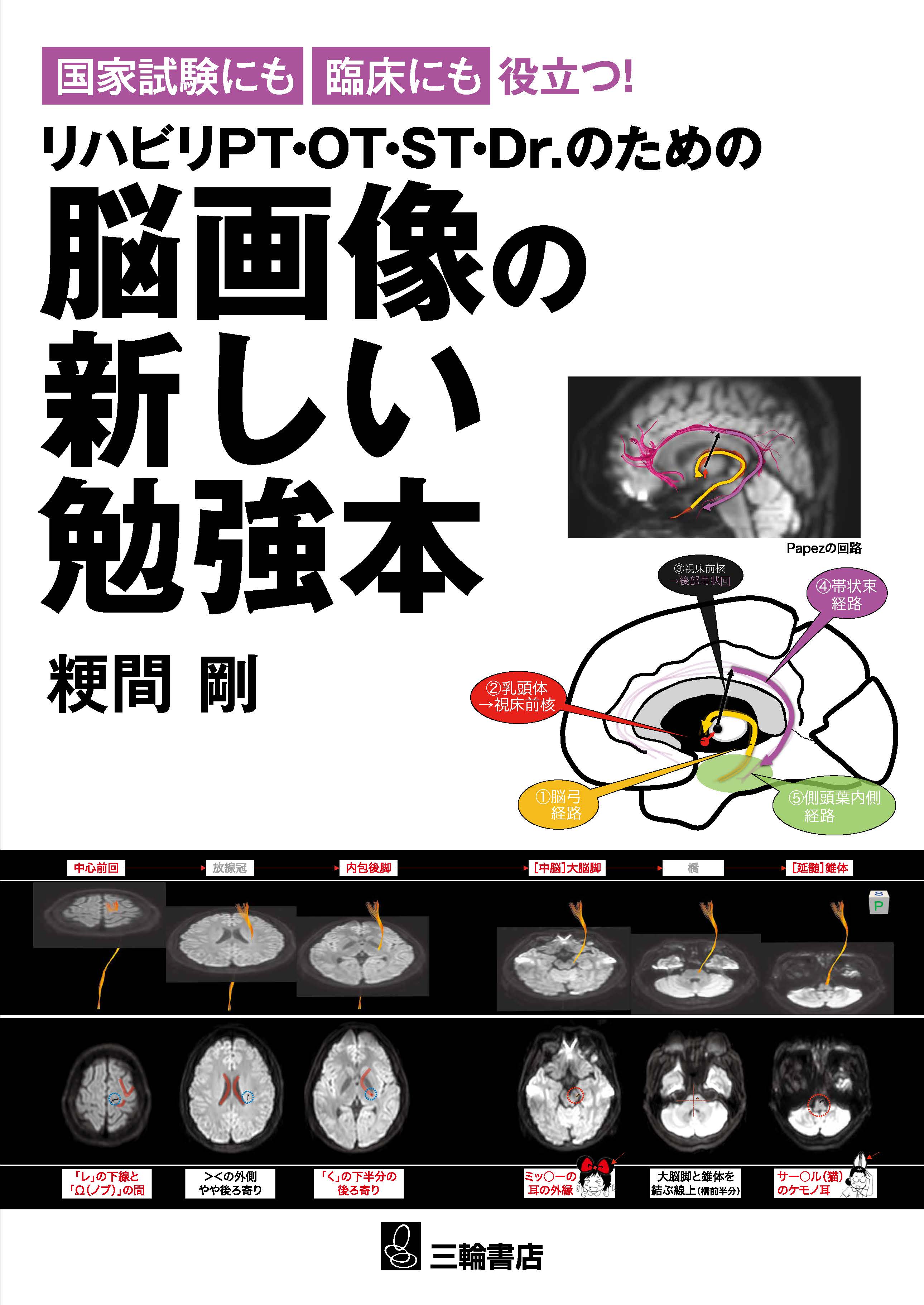 リハビリテーションにおける脳画像の活用　DVD 全２巻セット