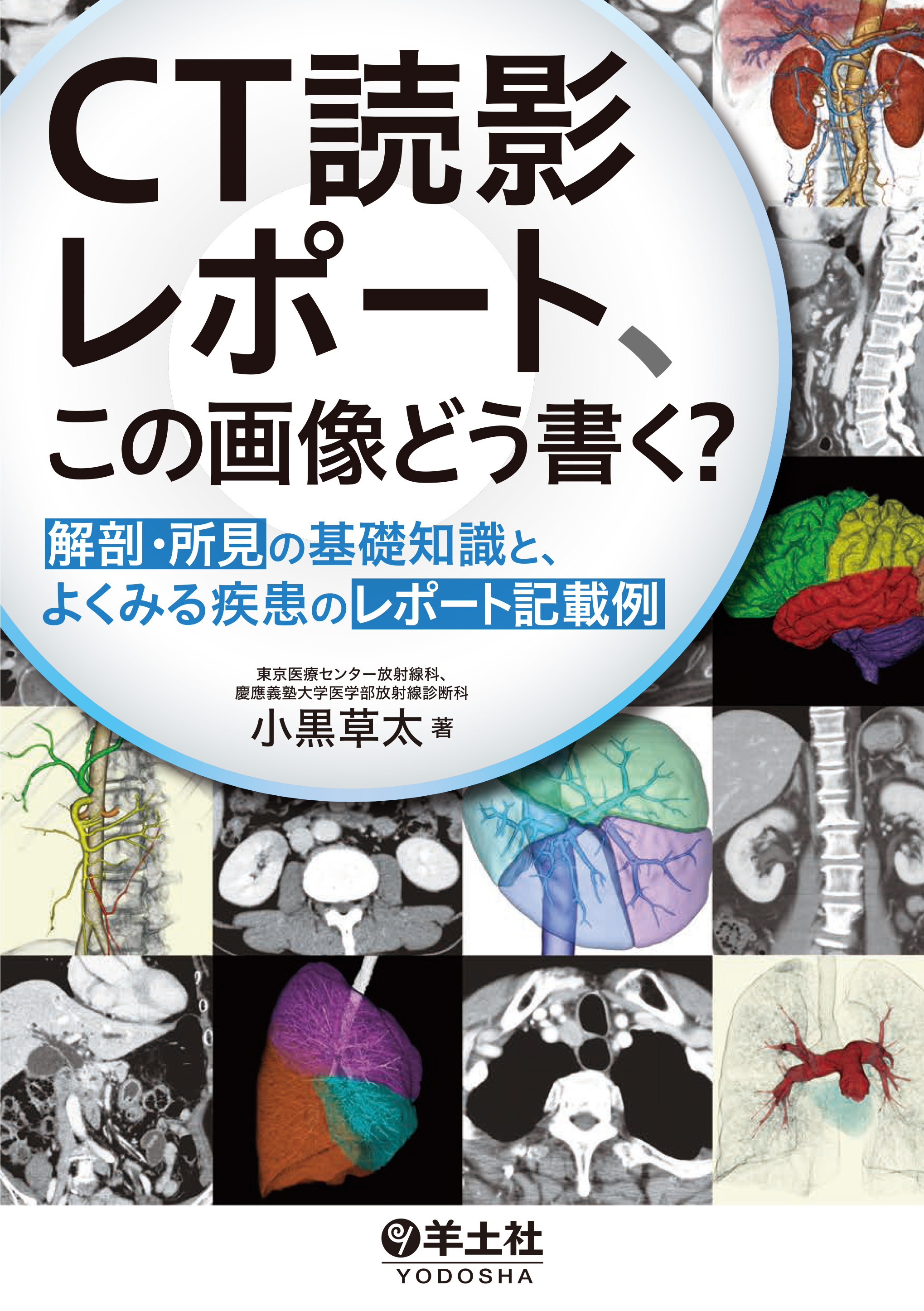 CT読影レポート、この画像どう書く？【電子版】 | 医書.jp