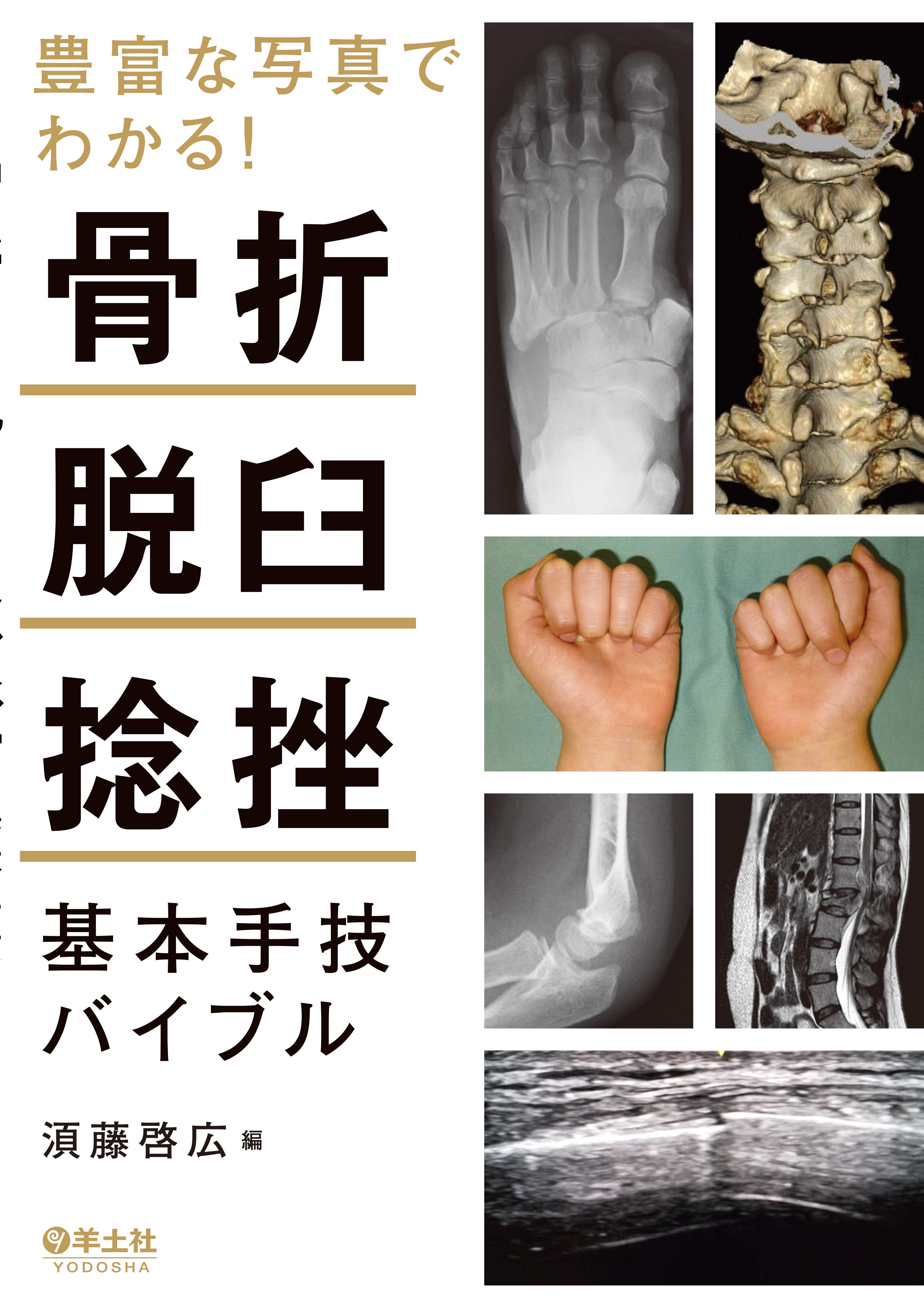 骨折・脱臼 改訂5版 | ethicsinsports.ch