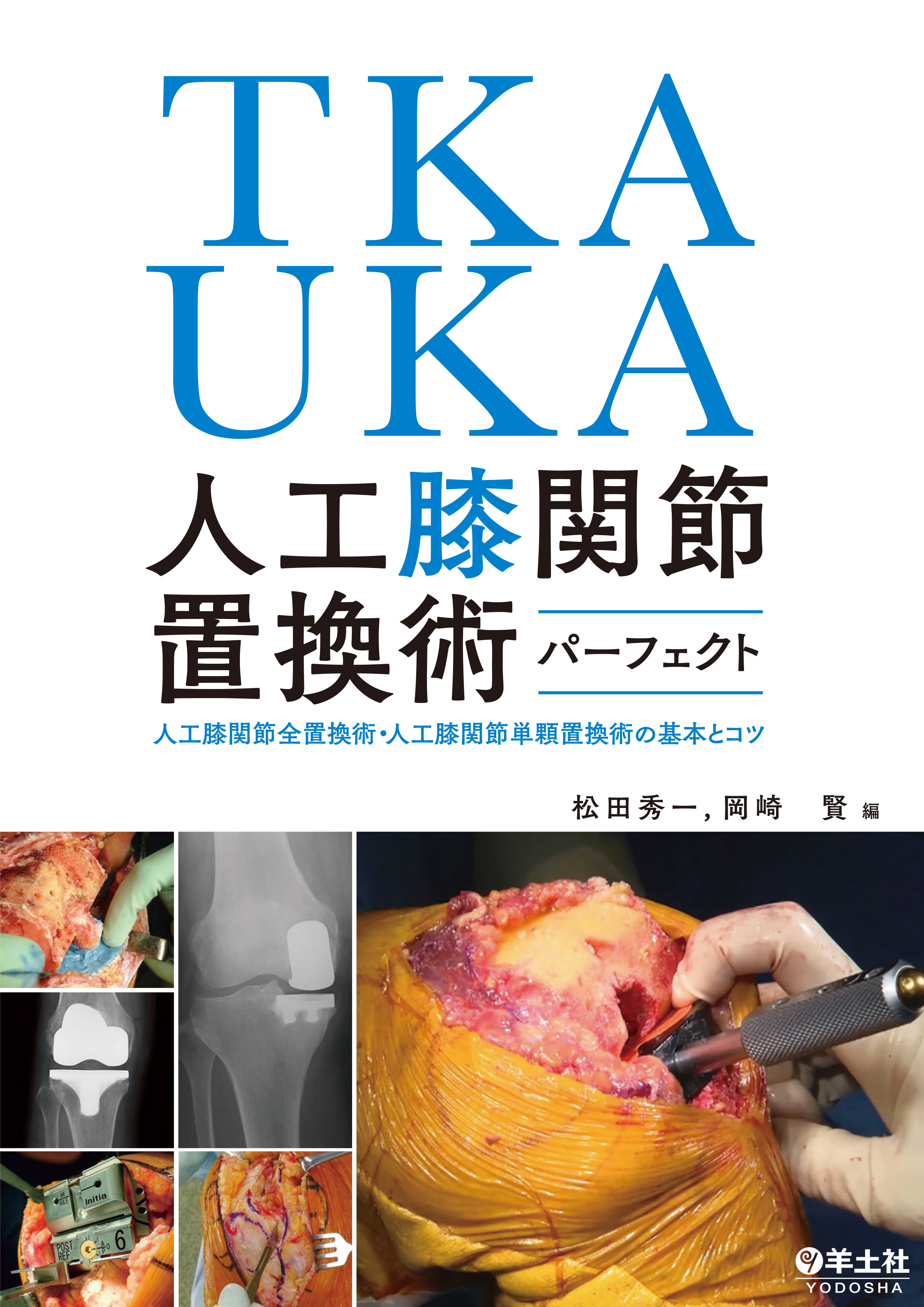 TKA・UKA 人工膝関節置換術パーフェクト【電子版】 | 医書.jp