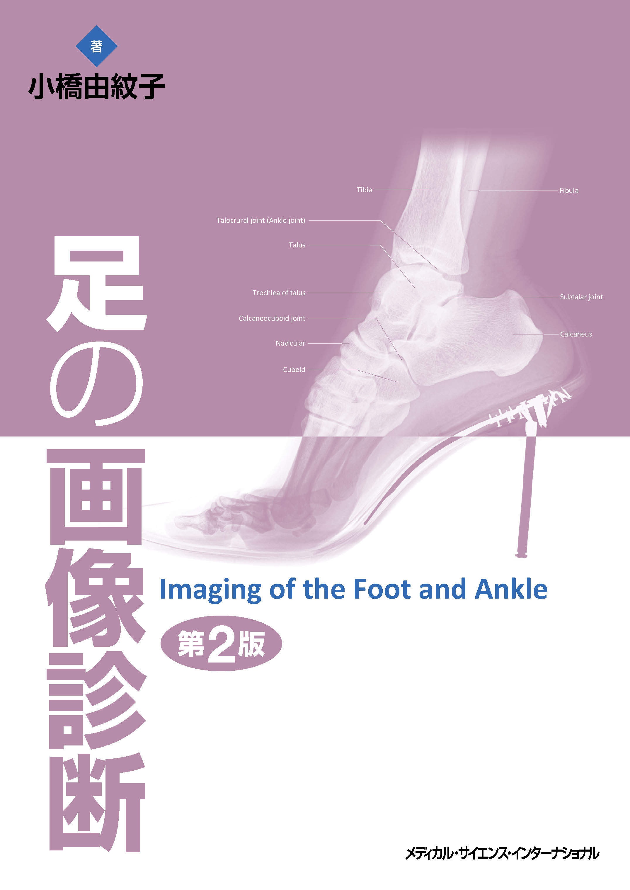 足の画像診断 第２版【電子版】 | 医書.jp