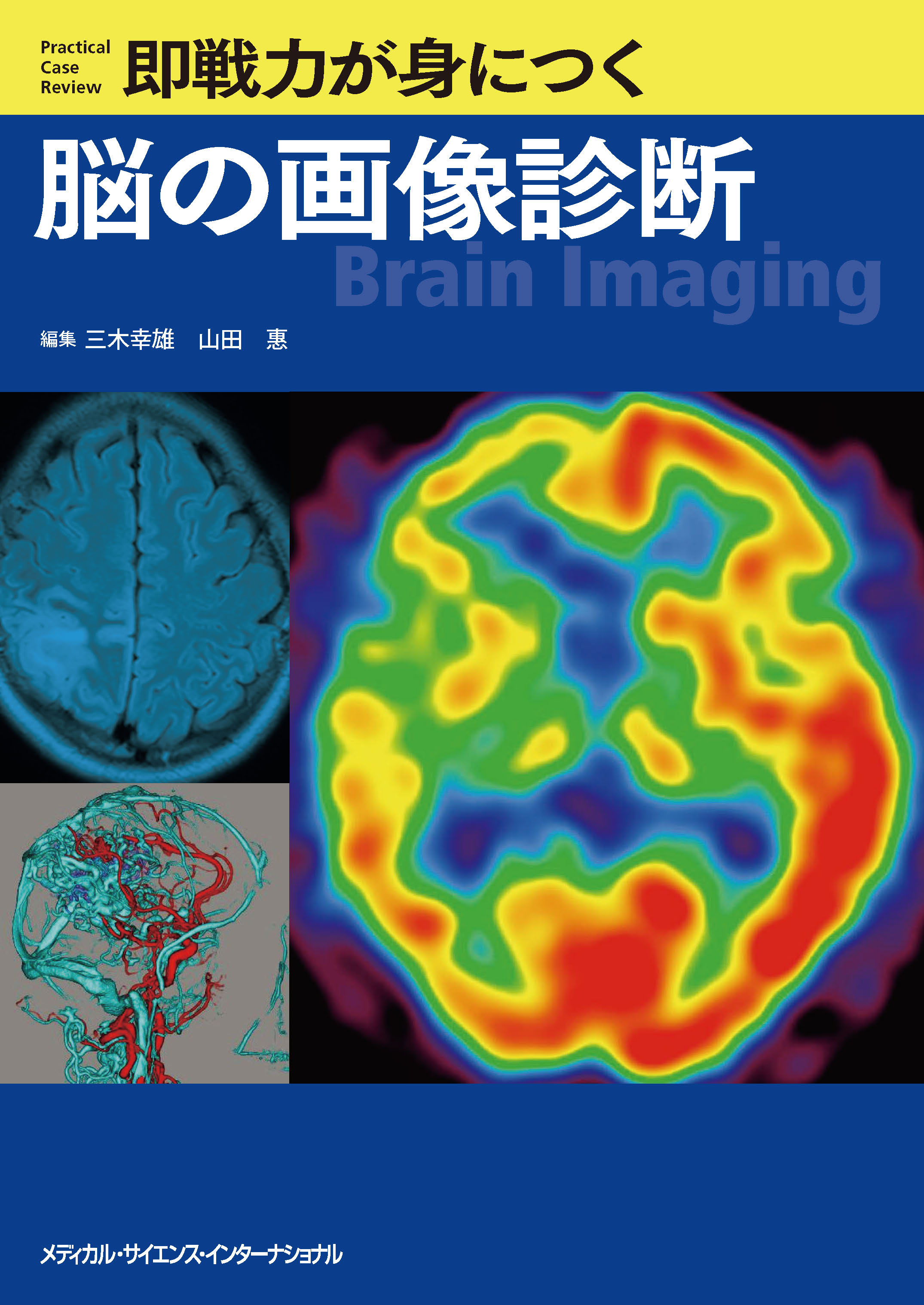 即戦力が身につく脳の画像診断【電子版】 | 医書.jp