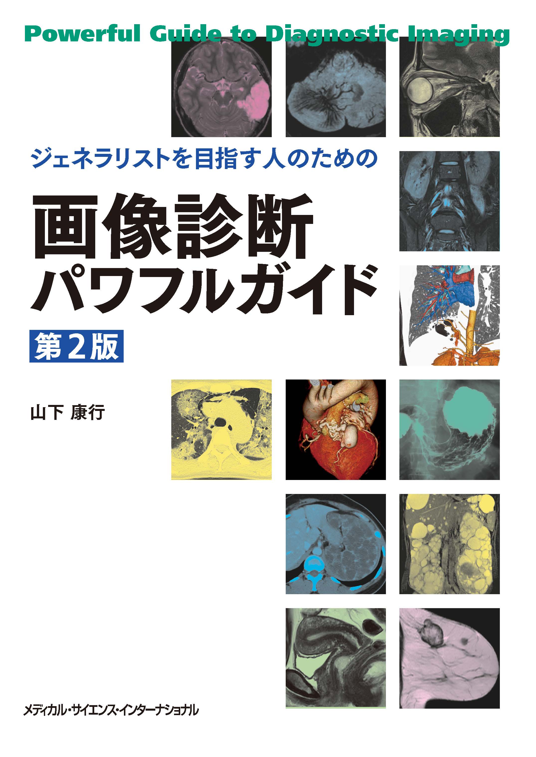 【最新版・第2版】ジェネラリストを目指す人のための画像診断パワフルガイド