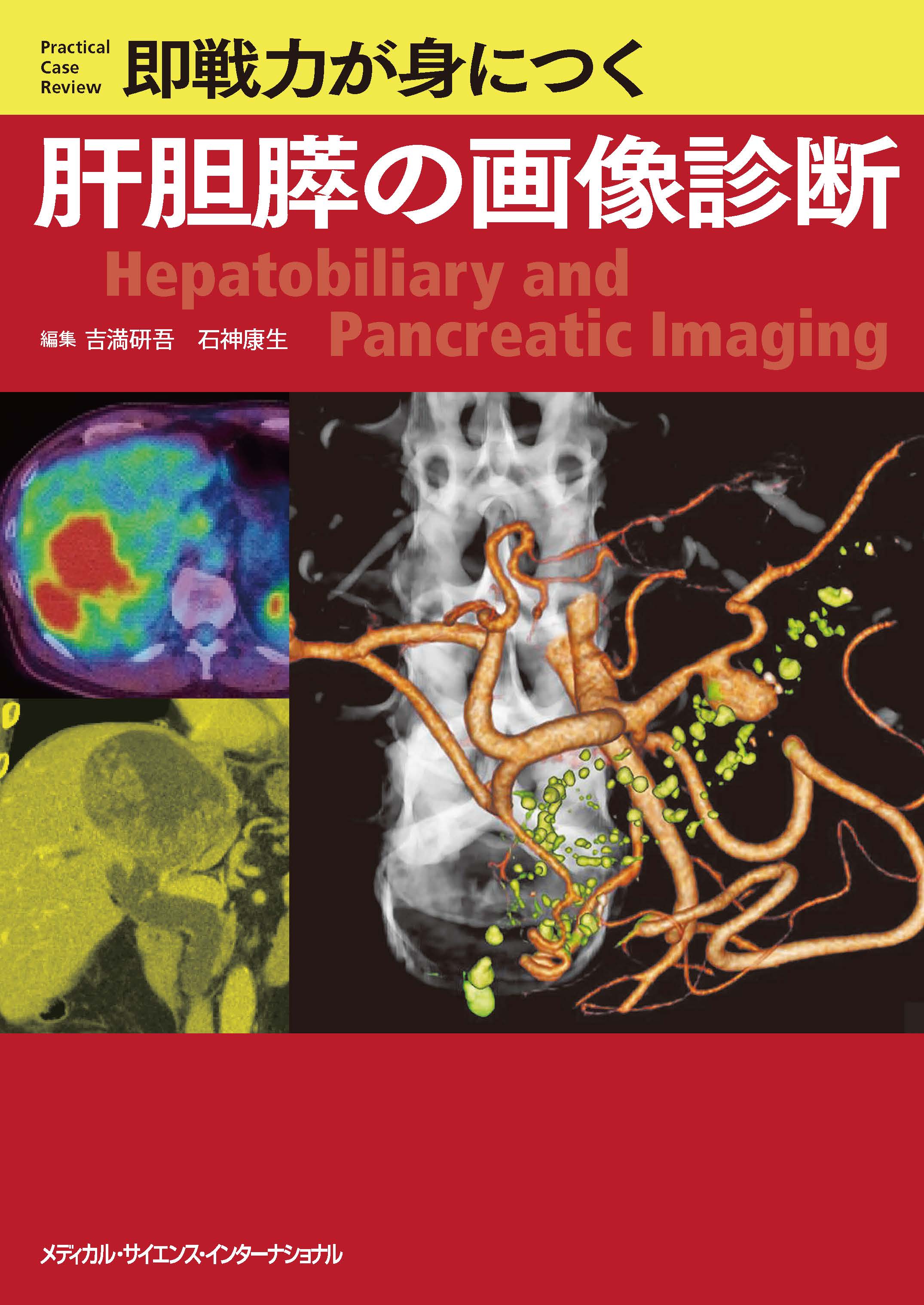 裁断済】即戦力が身につく肝胆膵の画像診断-