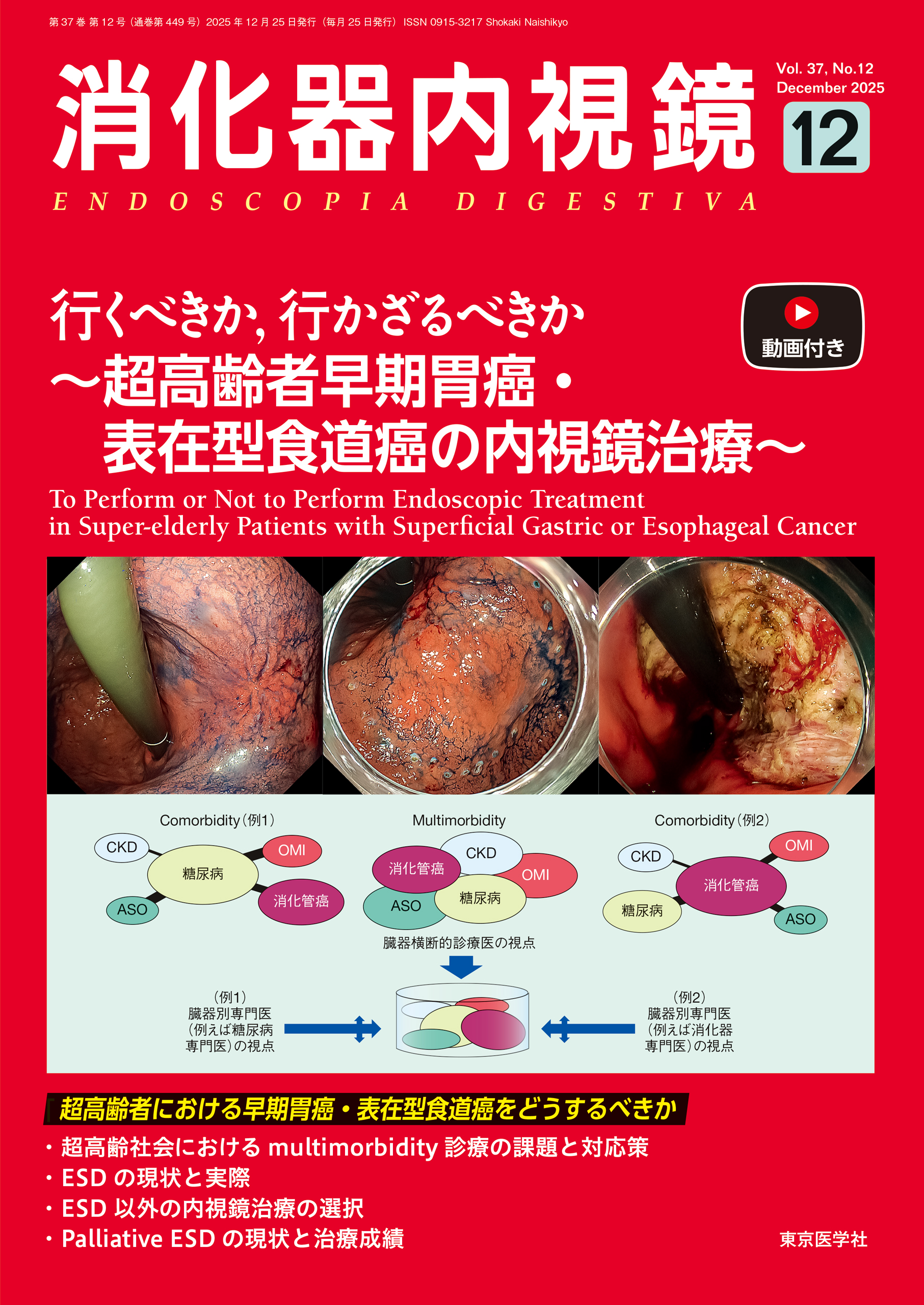 消化器12月6まで受付 消化器内視鏡年間購読2026年1月号～12月号＋増刊号【電子版