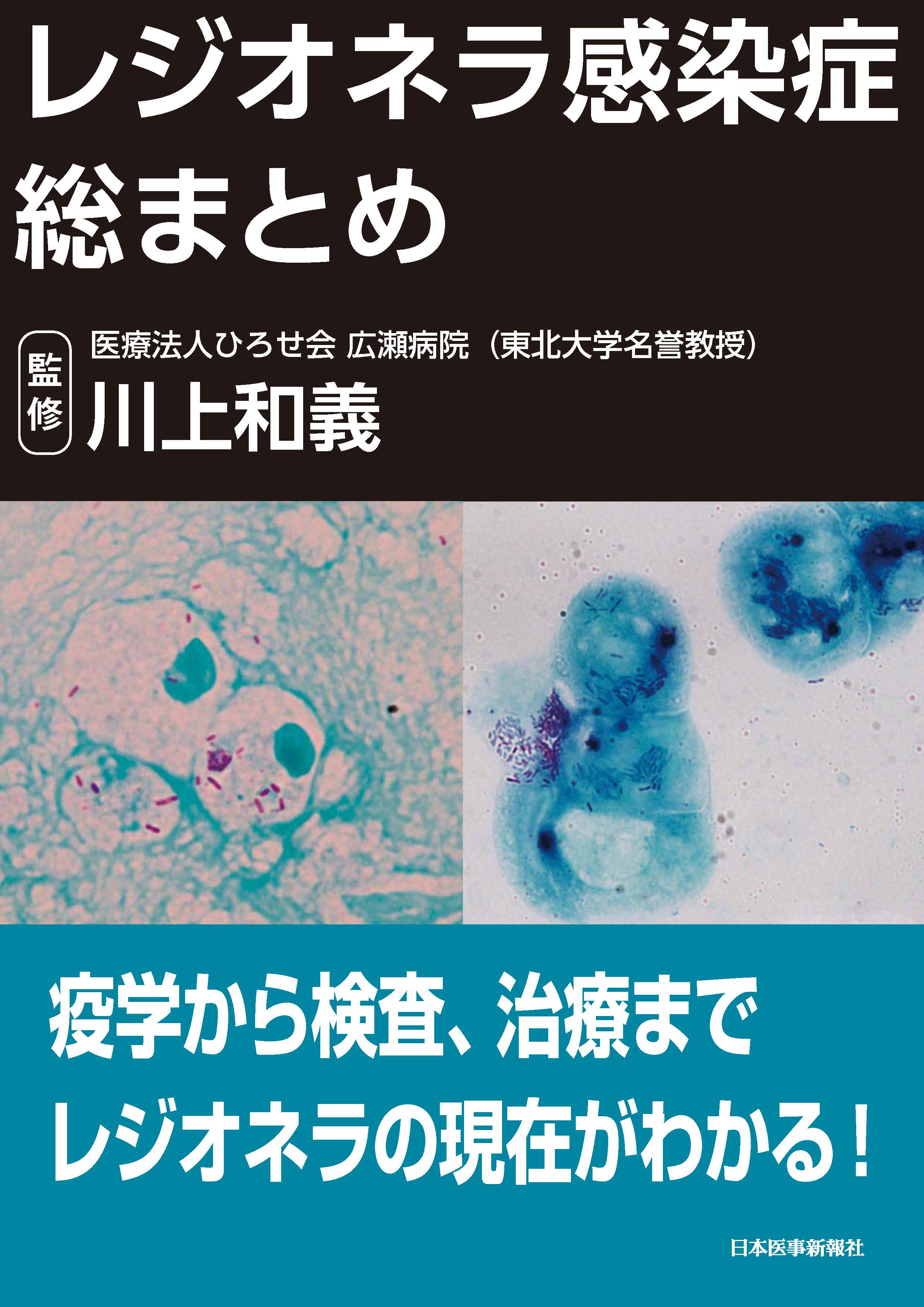 レジオネラ感染症総まとめ【電子版】 | 医書.jp