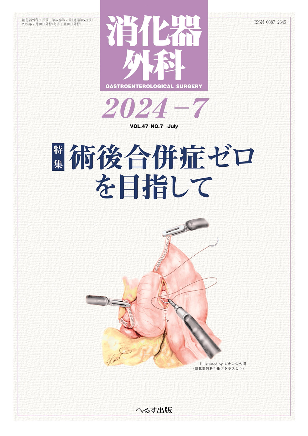 消化器外科2024年7月号【電子版】 | 医書.jp