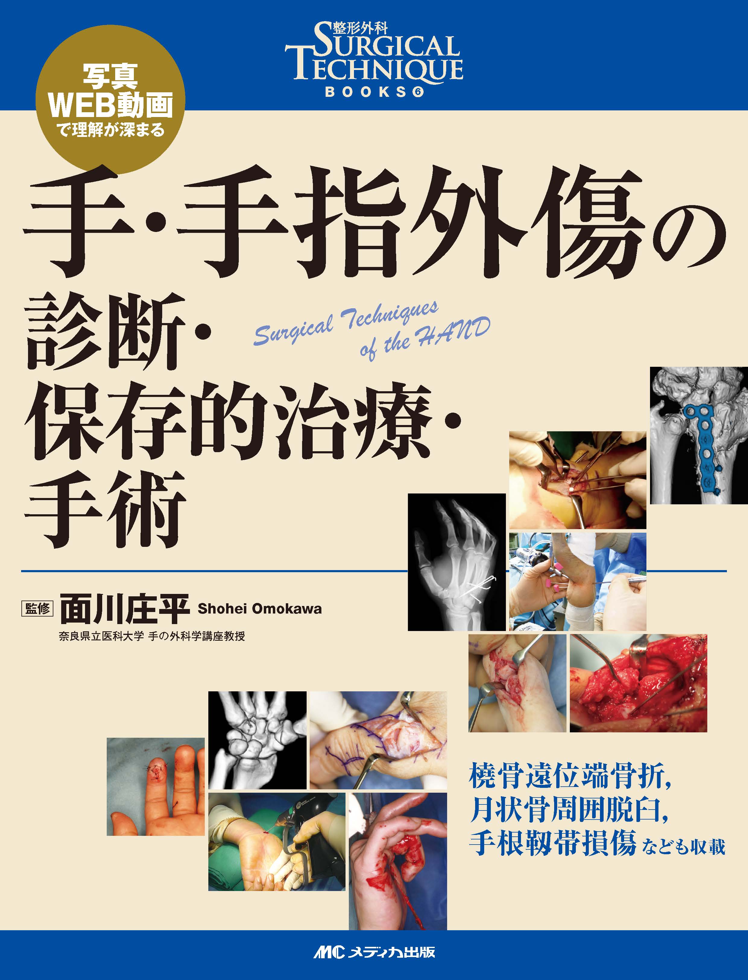 手・手指外傷の診断・保存的治療・手術【電子版】 | 医書.jp