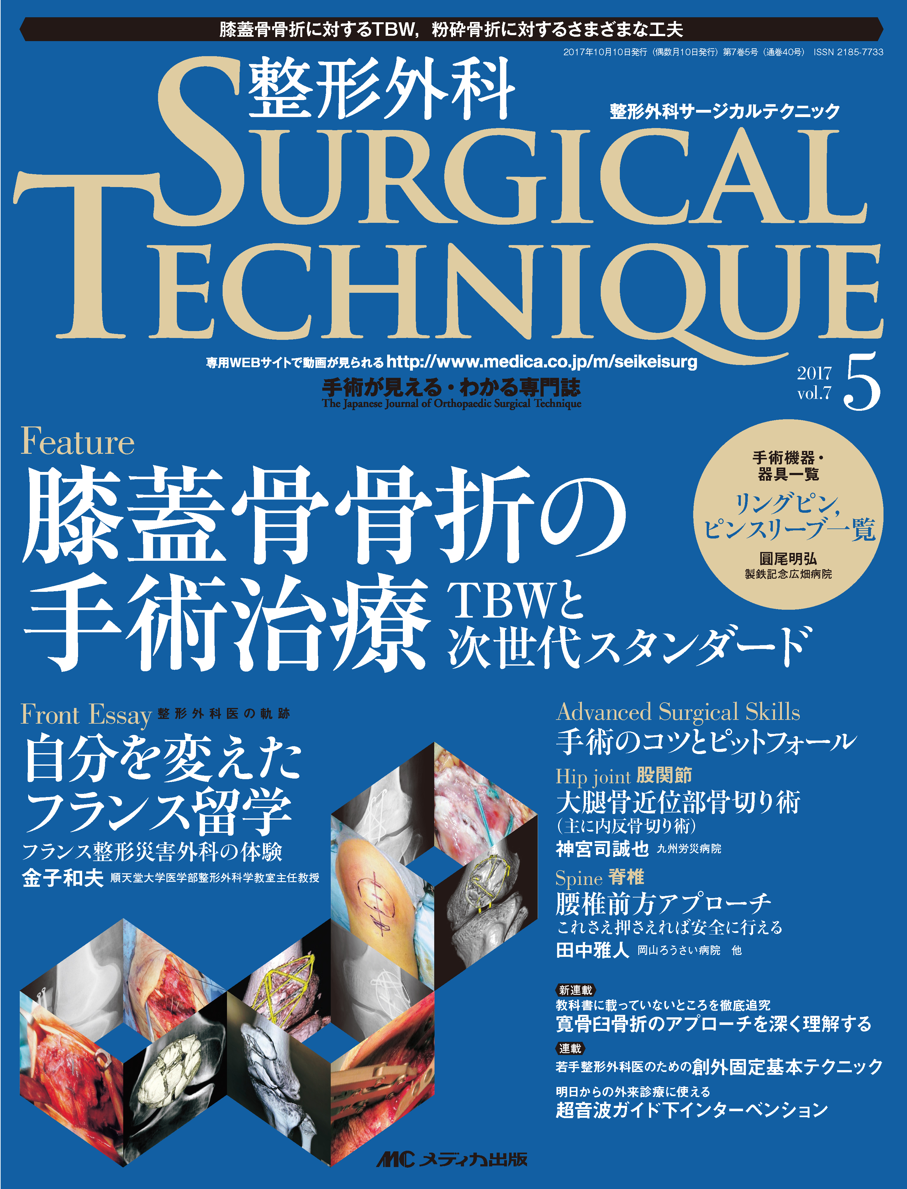 整形外科 SURGICAL TECHNIQUE（サージカルテクニック） 2017年5号【電子版】 | 医書.jp