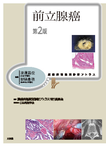 前立腺癌 第2版【電子版】 | 医書.jp