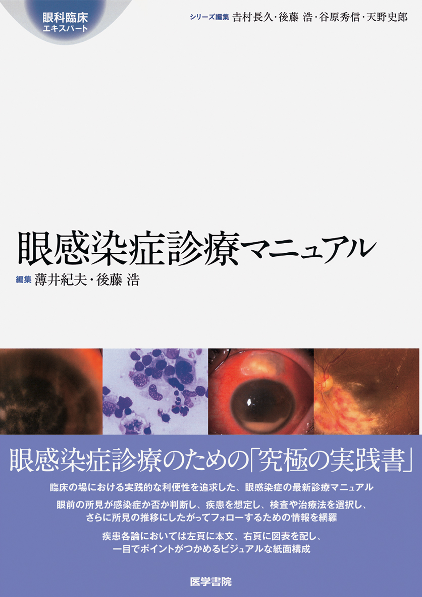 眼感染症診療マニュアル 眼感染症診療マニュアル | 医書.jp