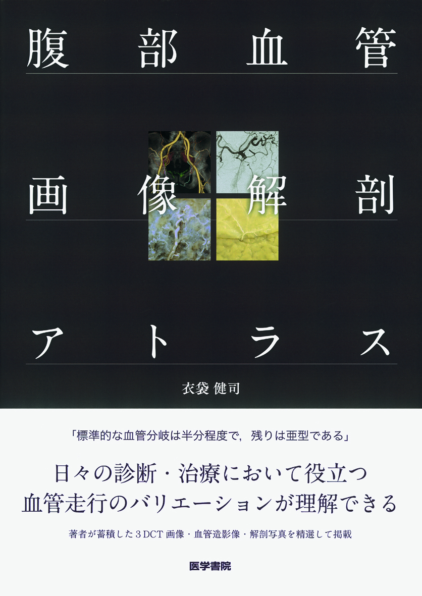 腹部血管画像解剖アトラス | 医書.jp