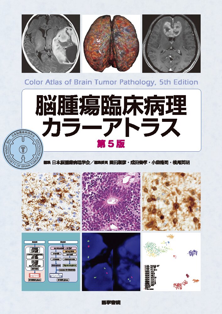 脳腫瘍臨床病理カラーアトラス 第5版 | 医書.jp