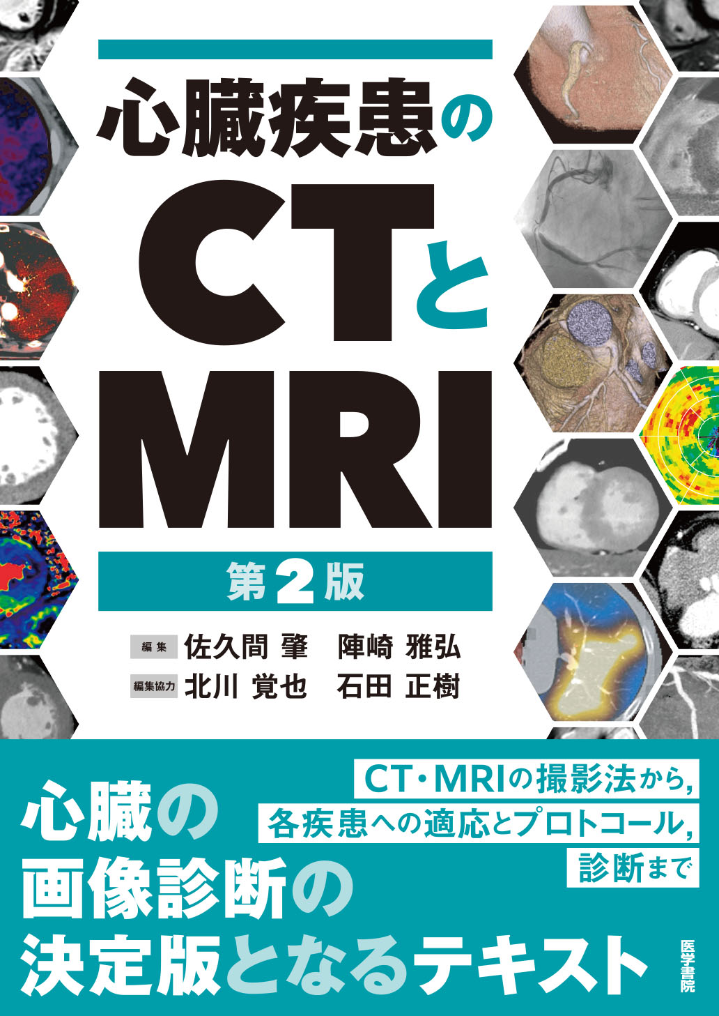 心臓疾患のCTとMRI 第2版 | 医書.jp