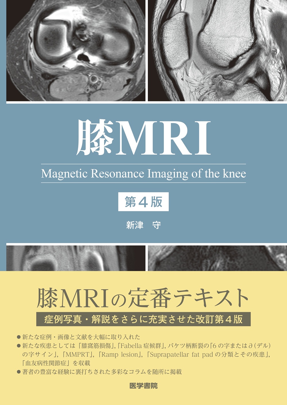 膝MRI 第4版 | 医書.jp