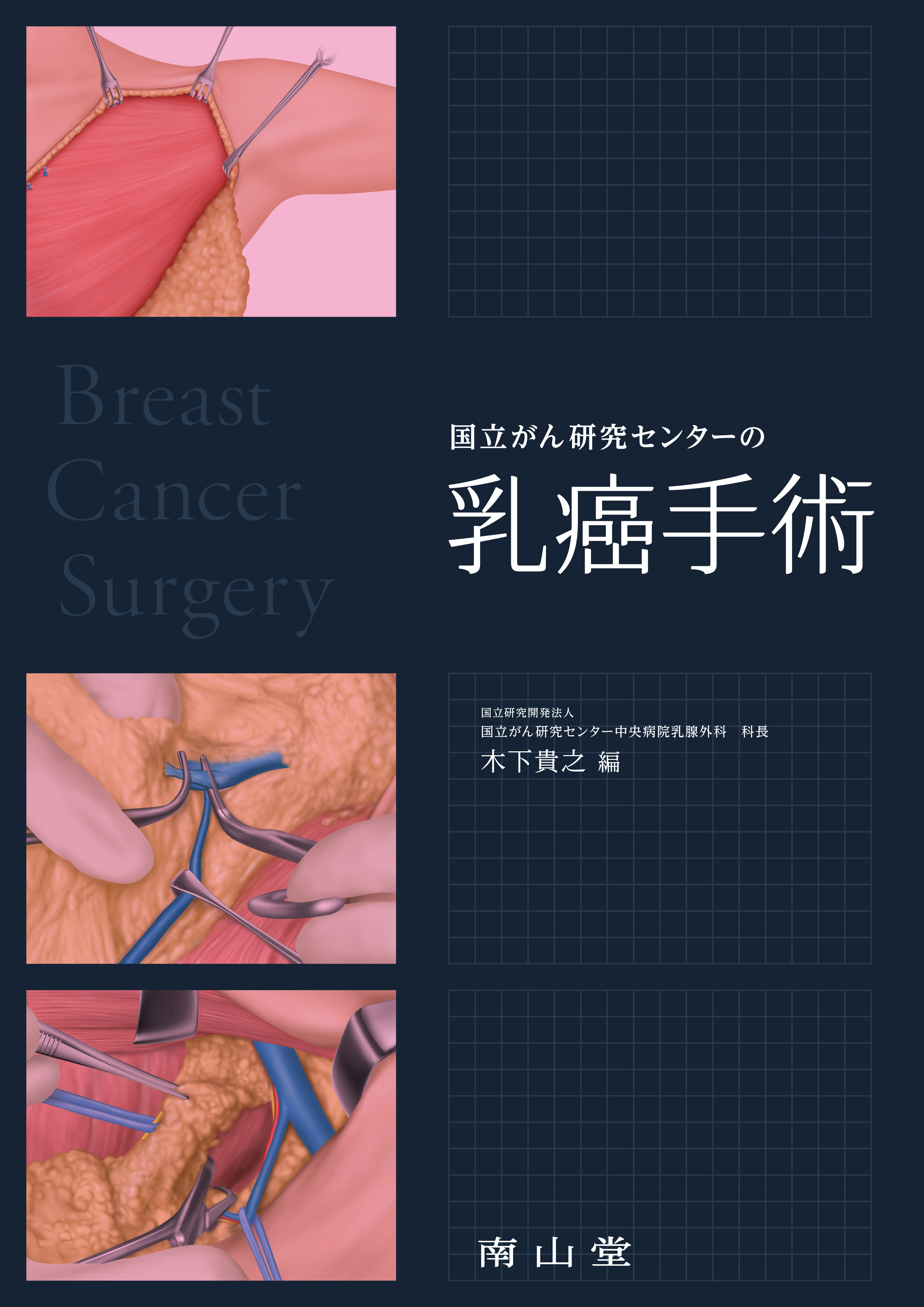 国立がん研究センターの乳癌手術 | 医書.jp